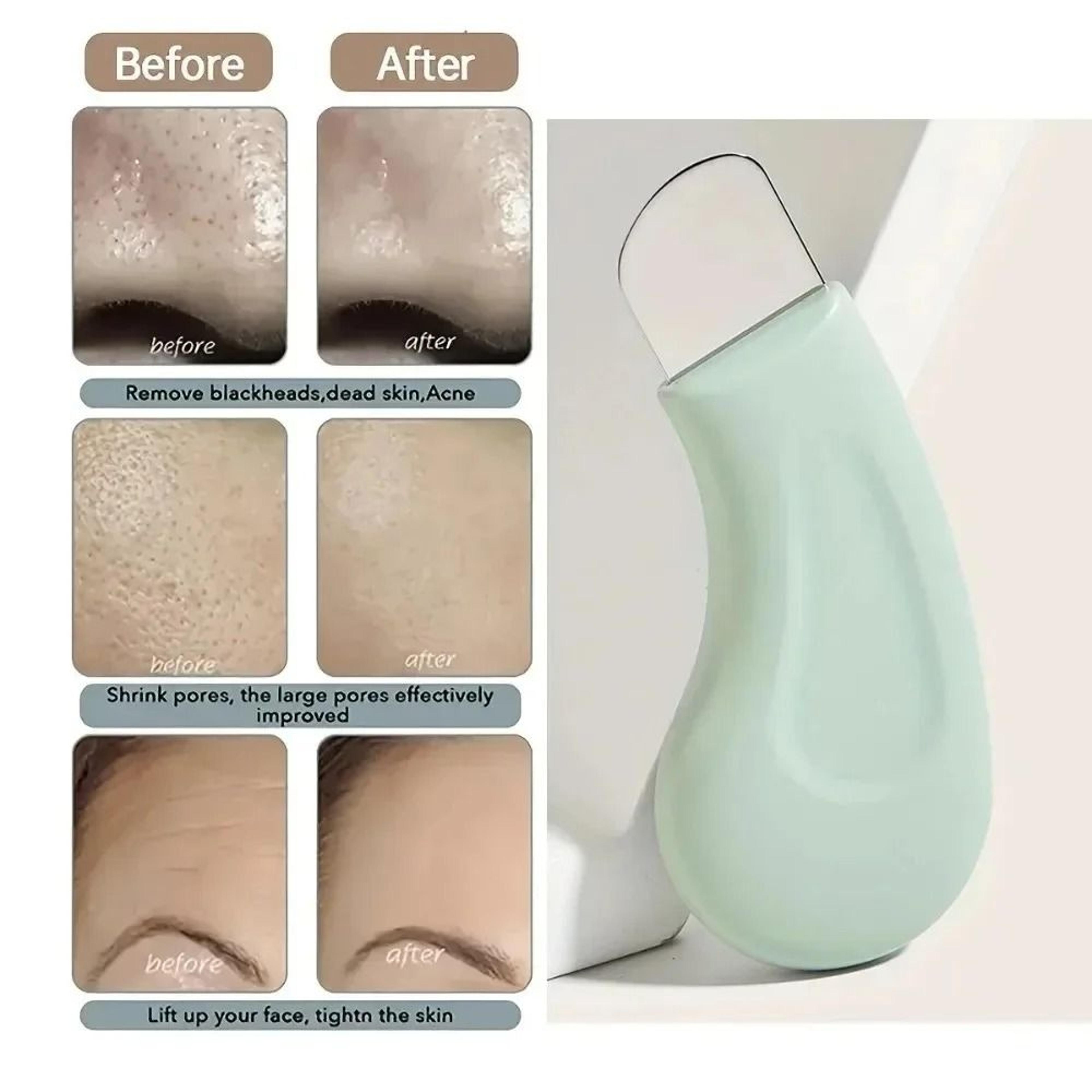 Silicone Facial Scraper And Gentle Pore Cleansing Blackhead Remover Tool 1
