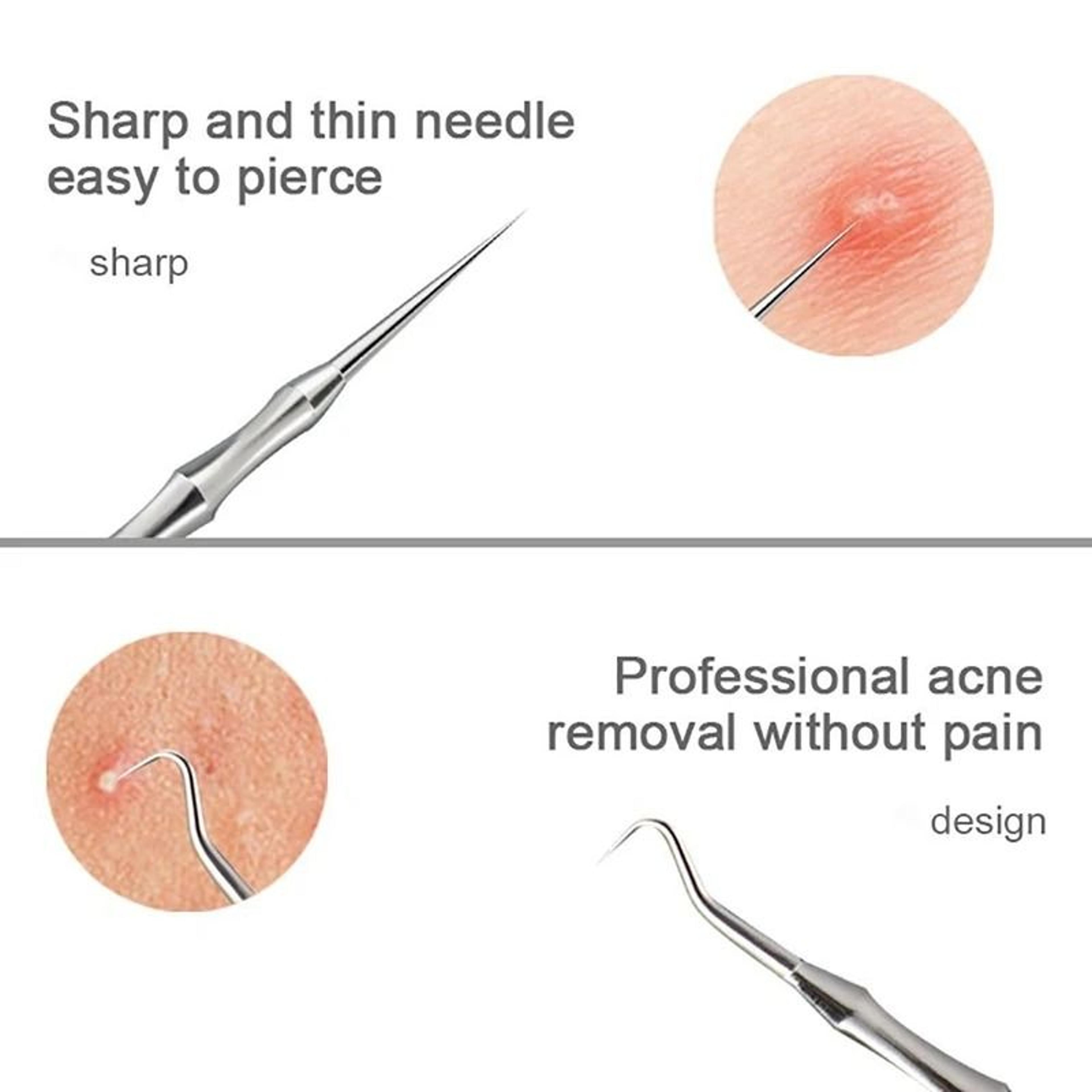 Professional Stainless Steel Milia Extractor And Blemish Removal Needle 4