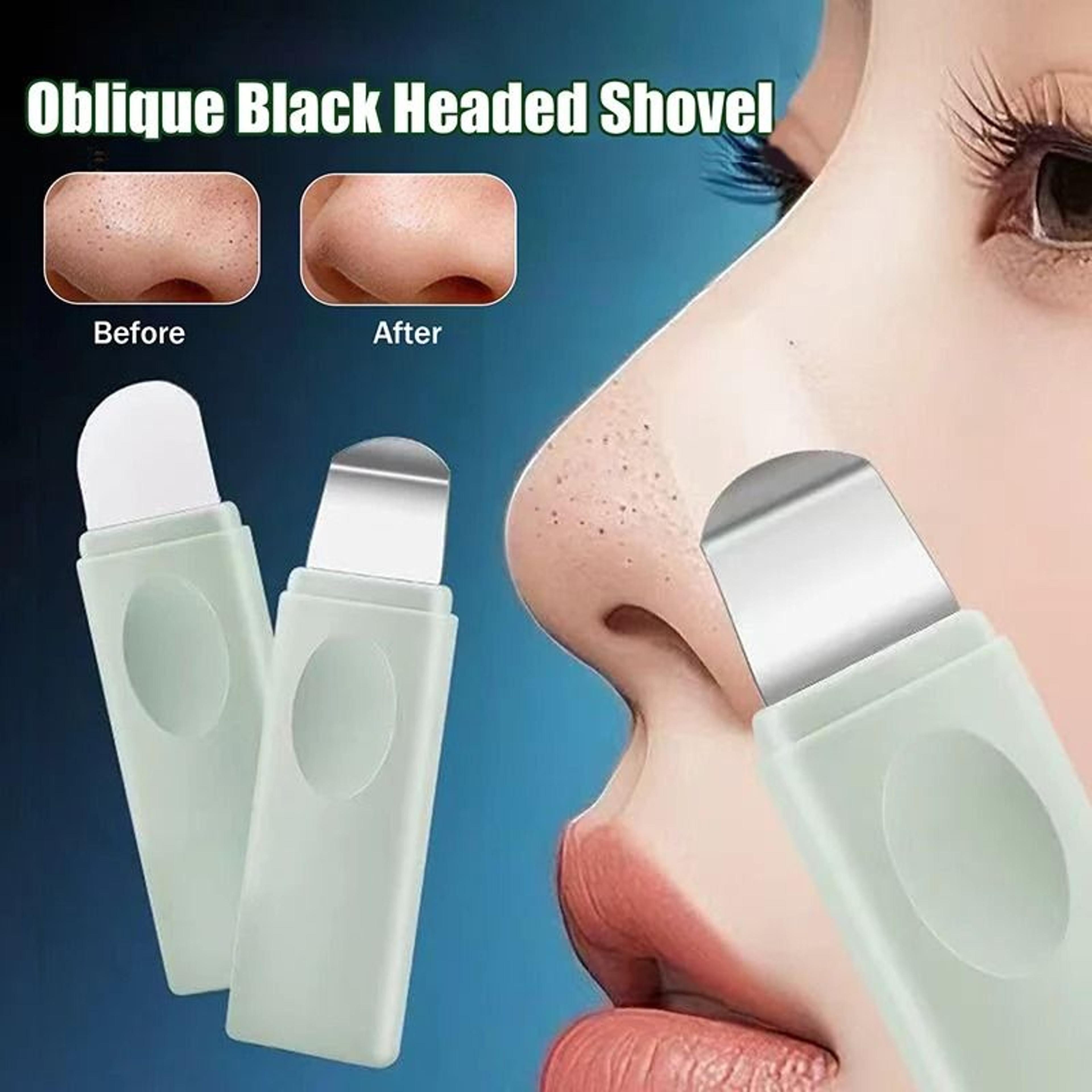 manual deep cleansing blackhead and whitehead removal tool