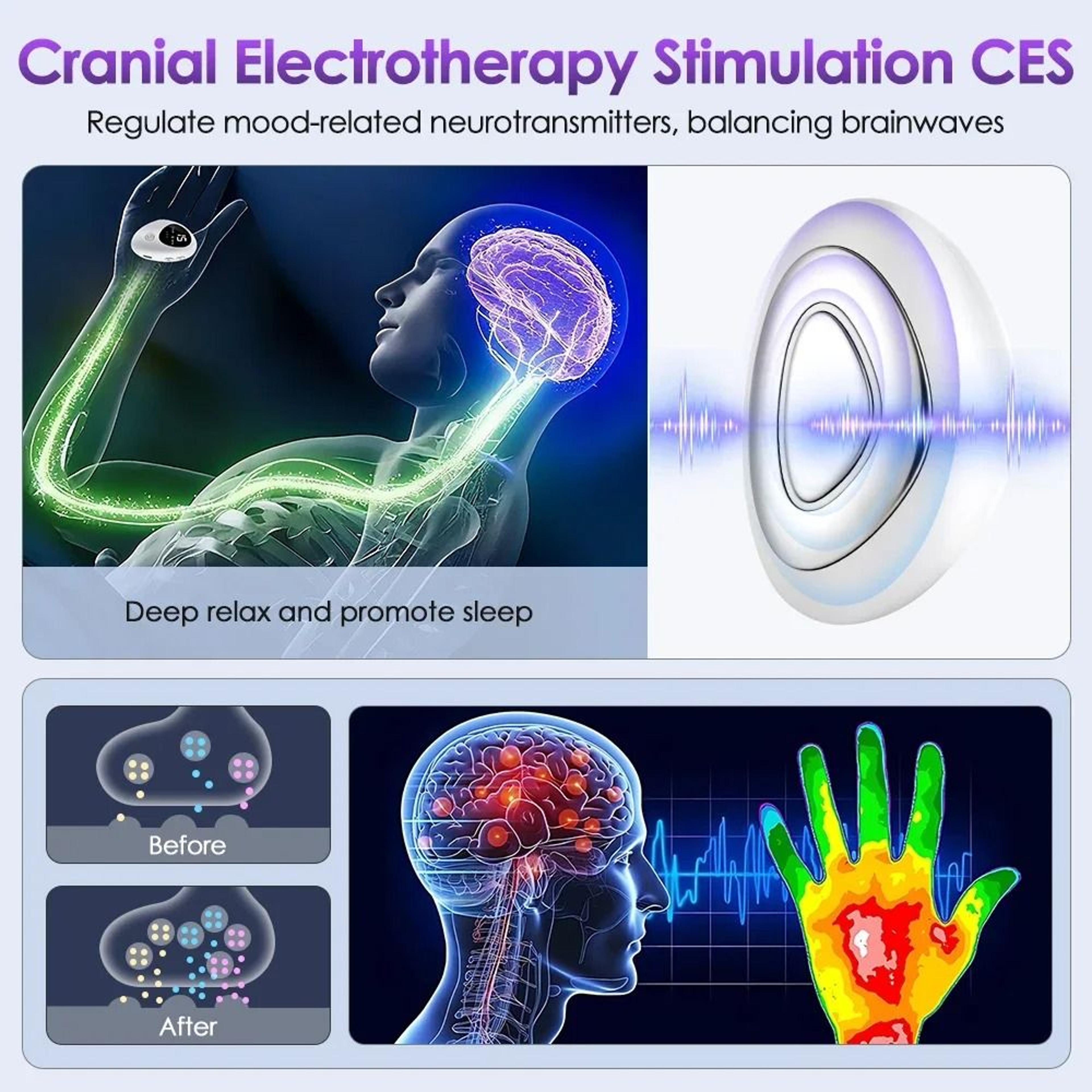 Microcurrent EMS Sleep Aid Device And Palm Pulse Massager For Insomnia Stress And Anxiety Relief 2