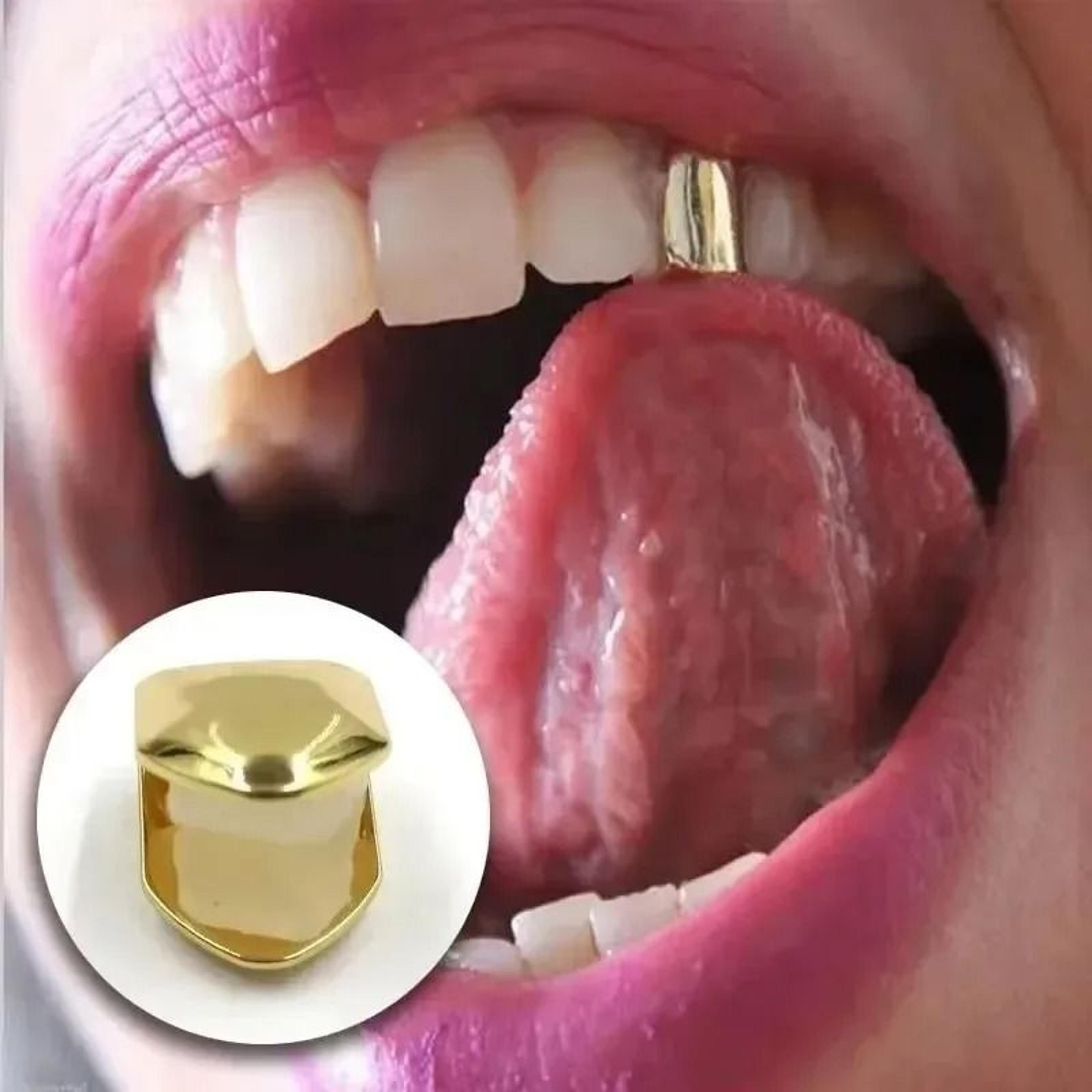 Gold Plated Single Tooth Cap Grill 1 2 Or 3 Pack 1