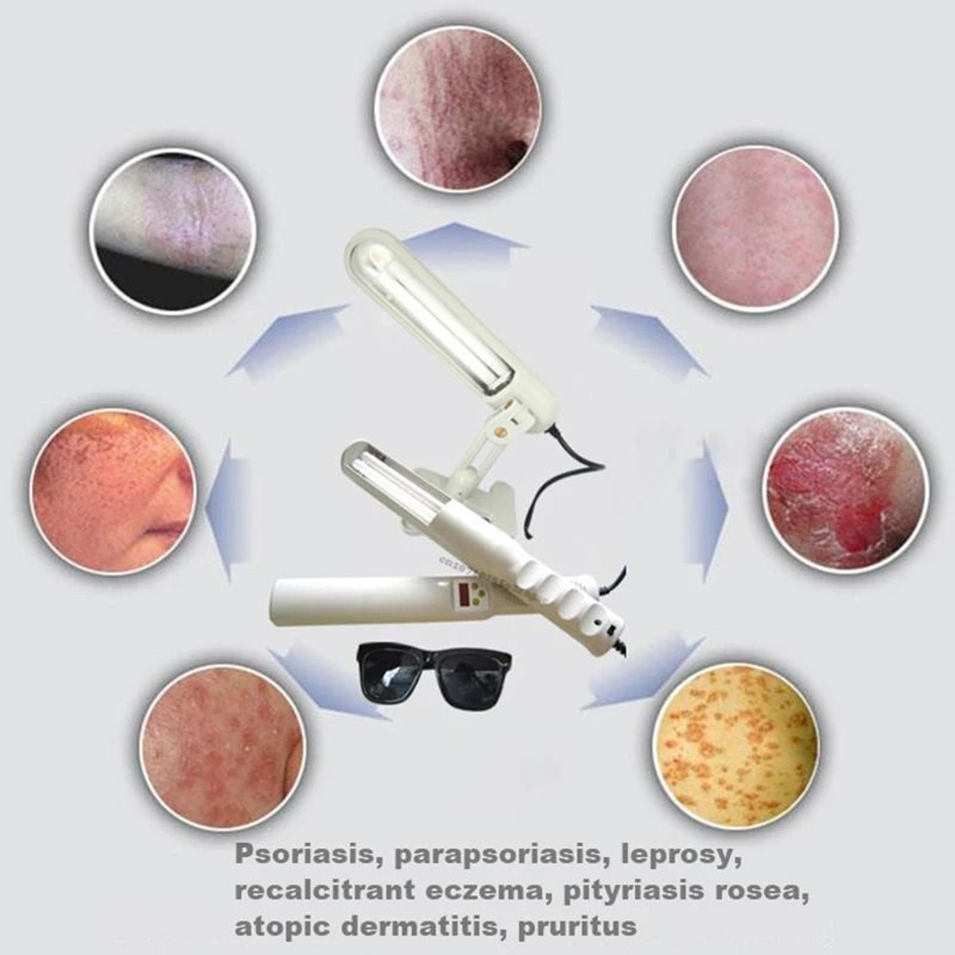 Targeted Narrowband UVB Phototherapy Lamp For Skin Care Maintenance 1