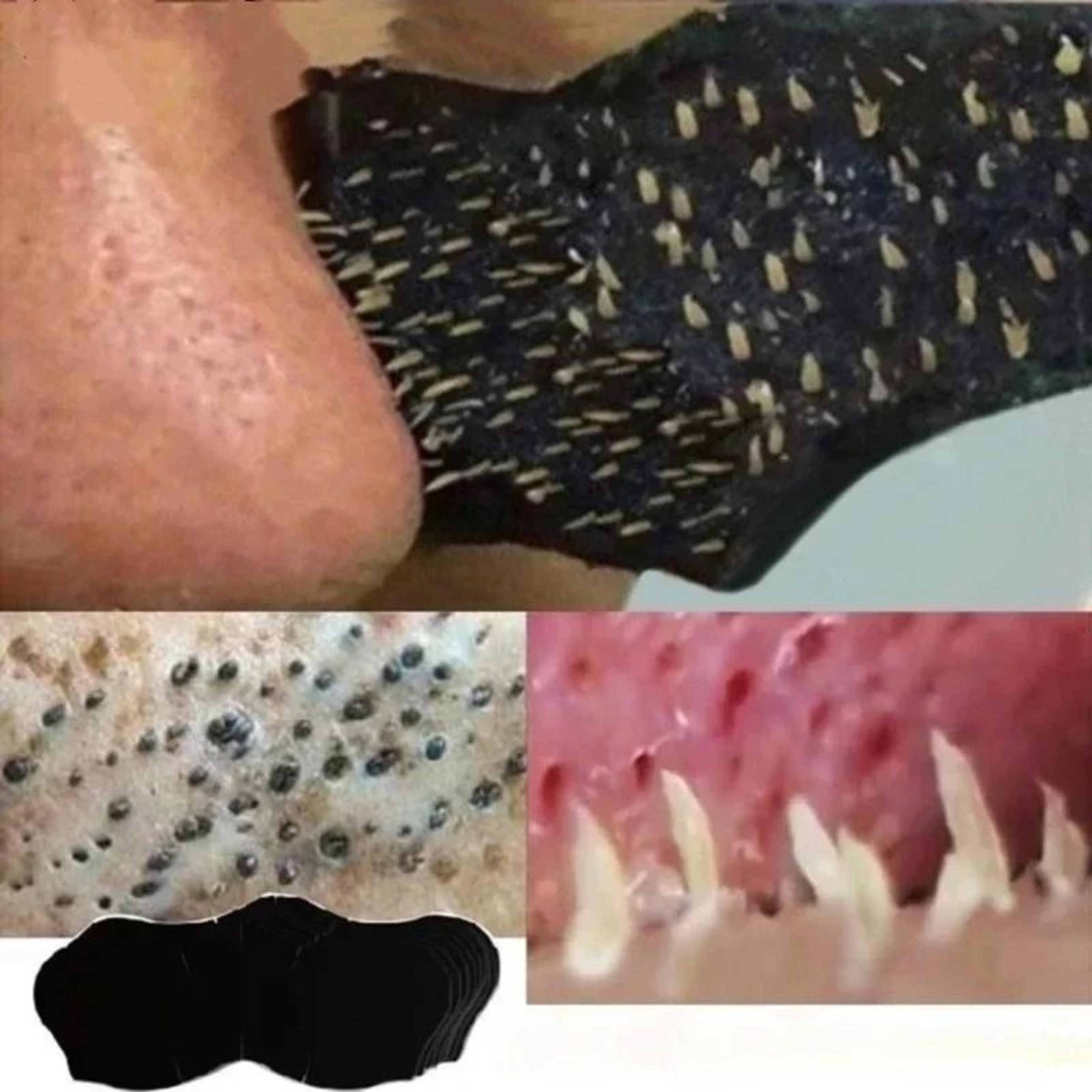 unisex deep cleansing blackhead remover nasal strips and pore shrinking nose patches