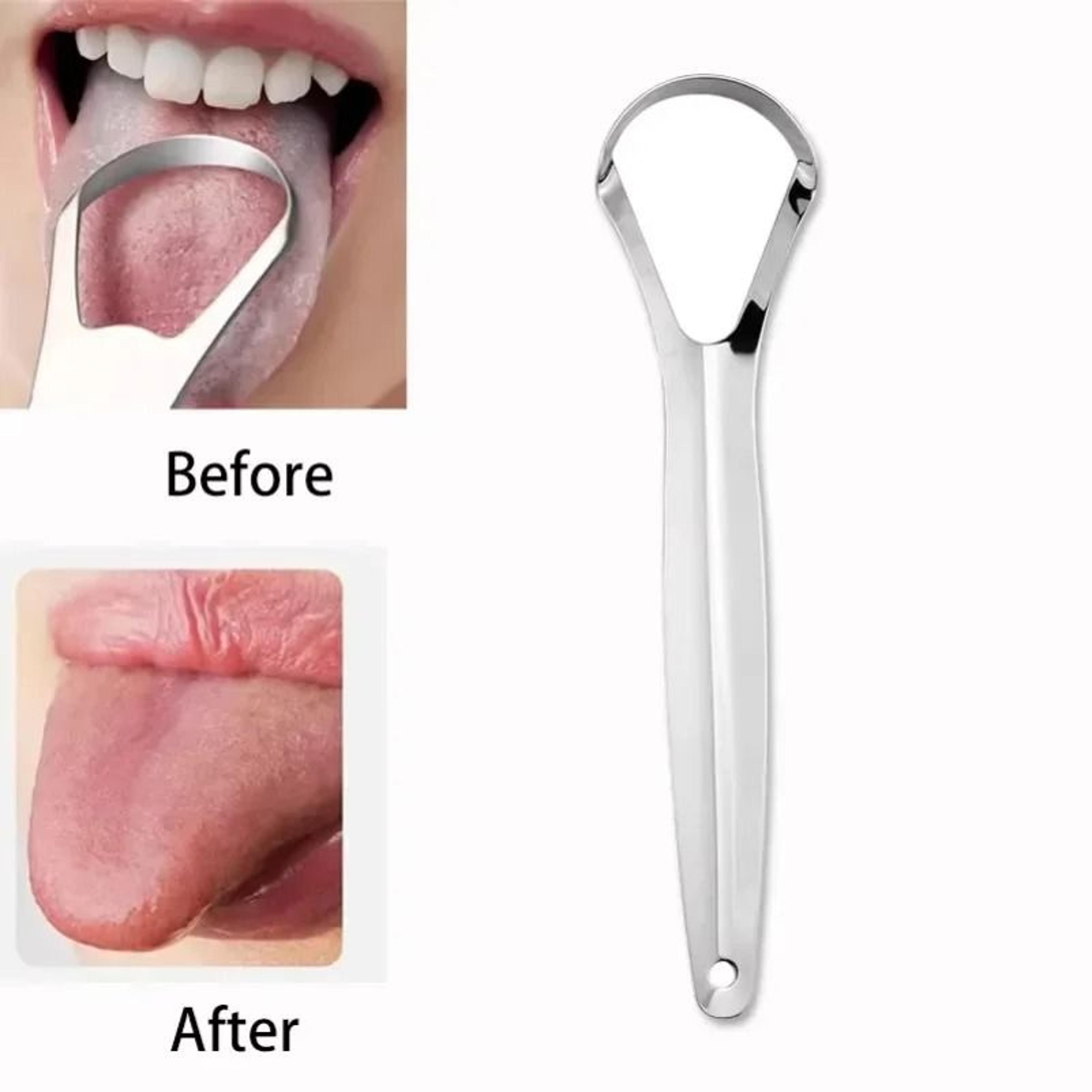 Stainless Steel Tongue Scraper And Halitosis Removal Oral Cleaner Brush 2