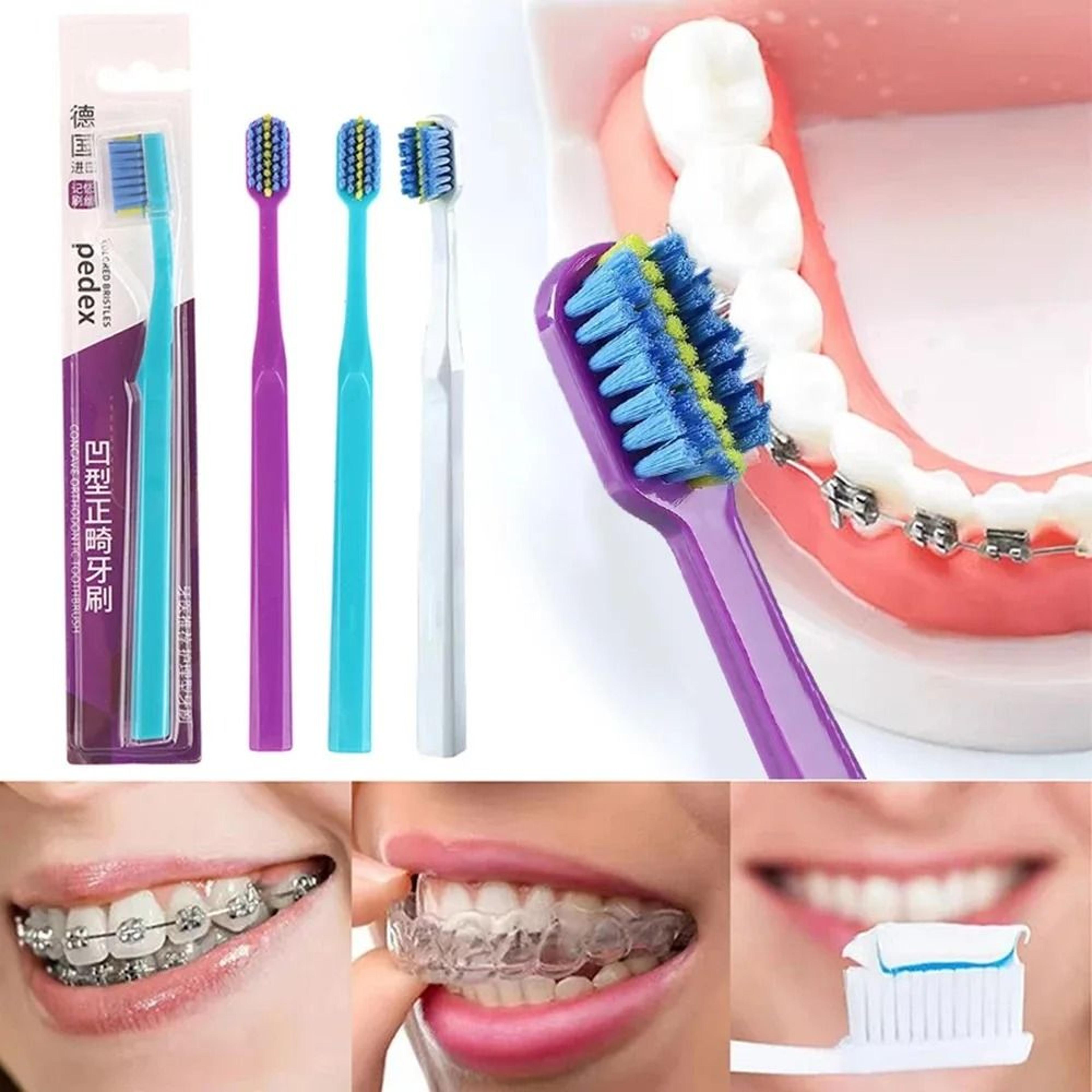 professional orthodontic toothbrush with soft bristles and interdental brush for braces care