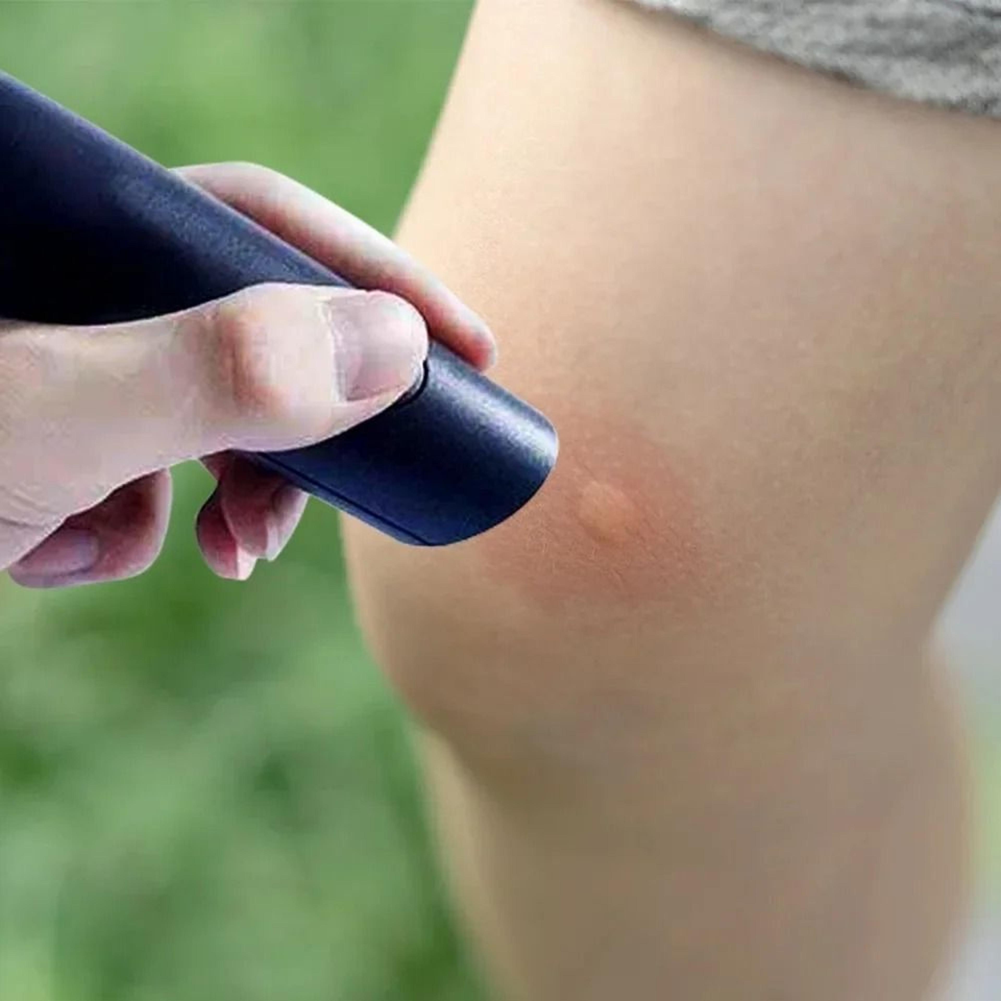 electronic mosquito bite relief pen for itch pain and swelling relief