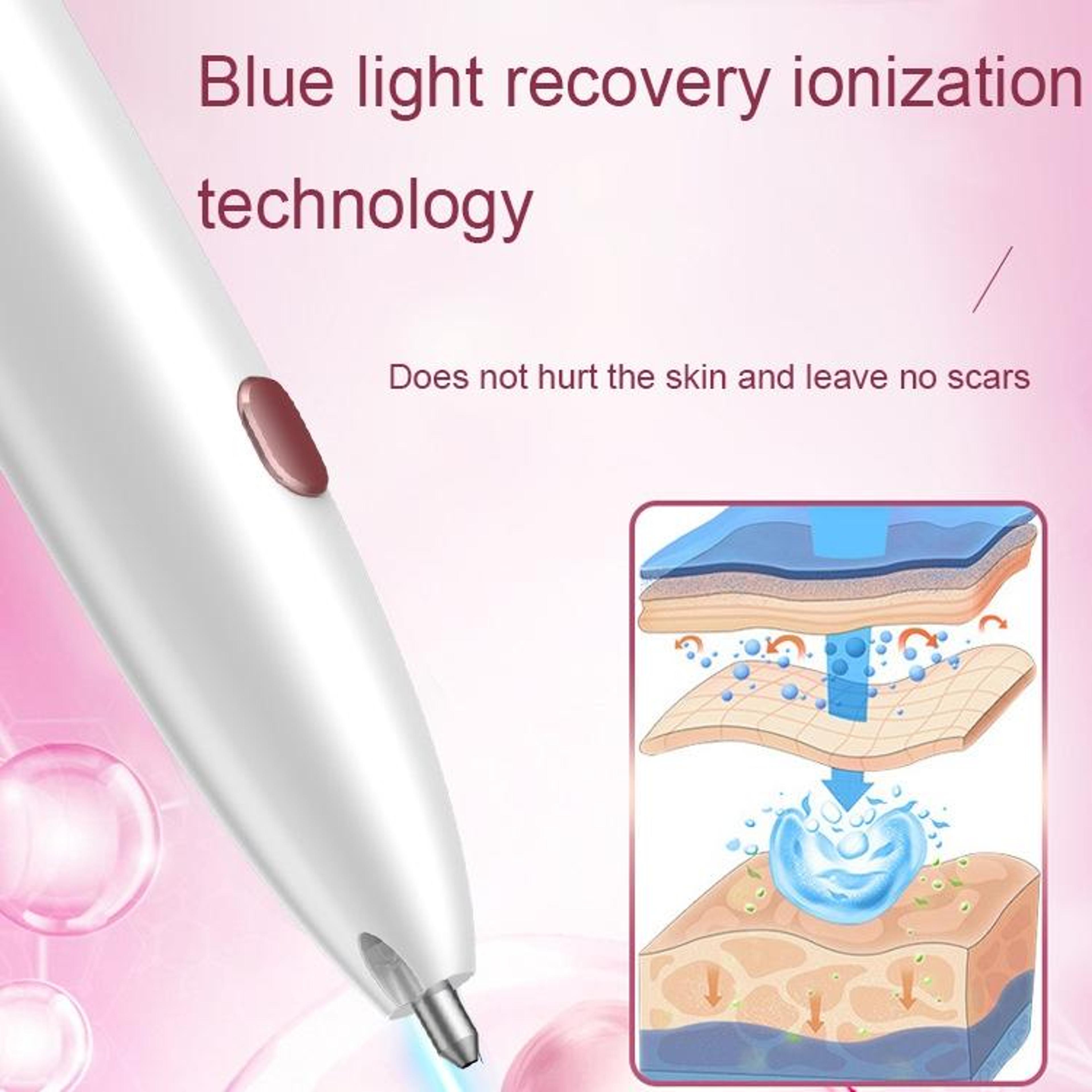 Precision Mole Removal Pen With 9 Levels LED Display  Blue Light Care 6