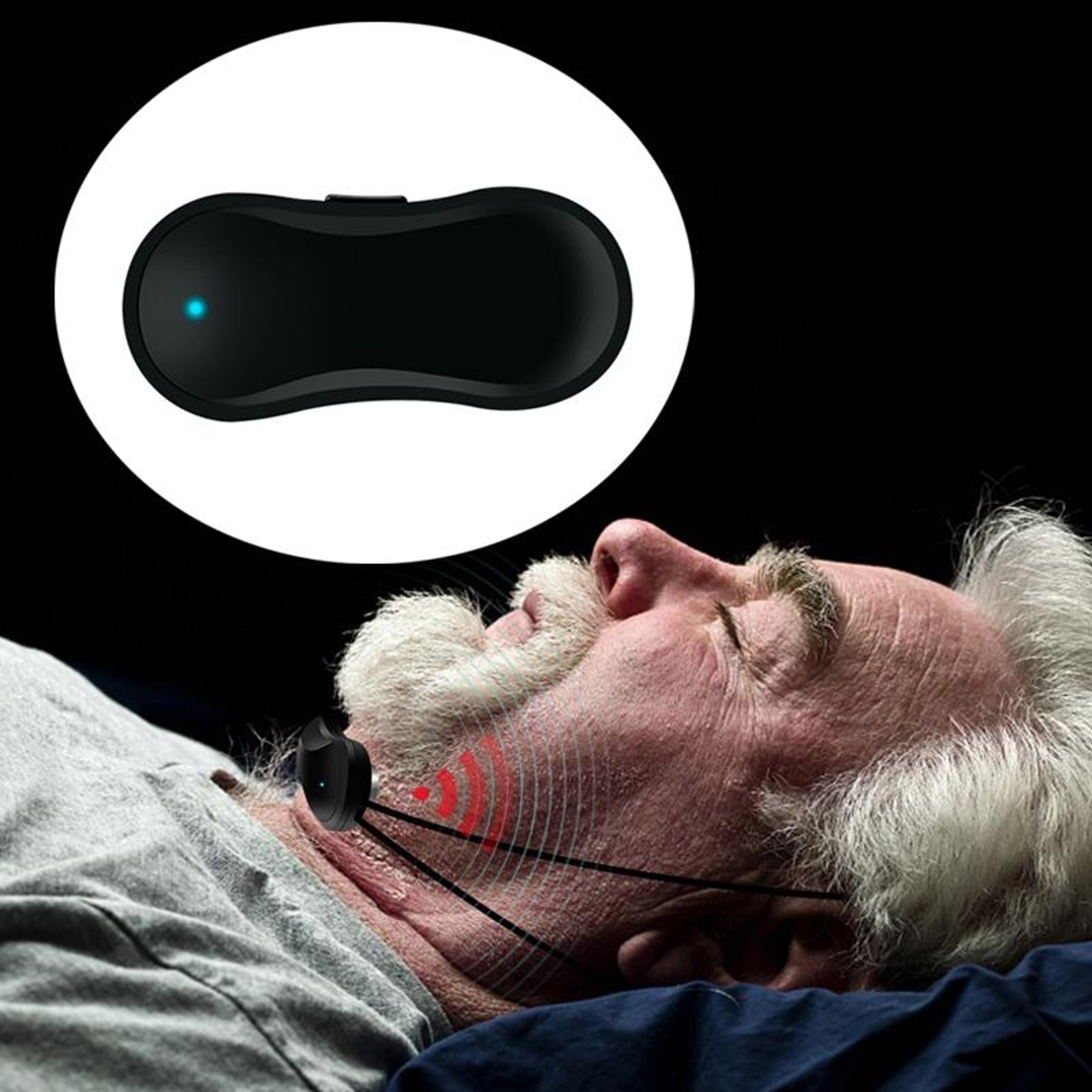 Smart USB Rechargeable Anti-Snoring Sleep Aid Device for Quiet Nights & Better Breathing – view 1