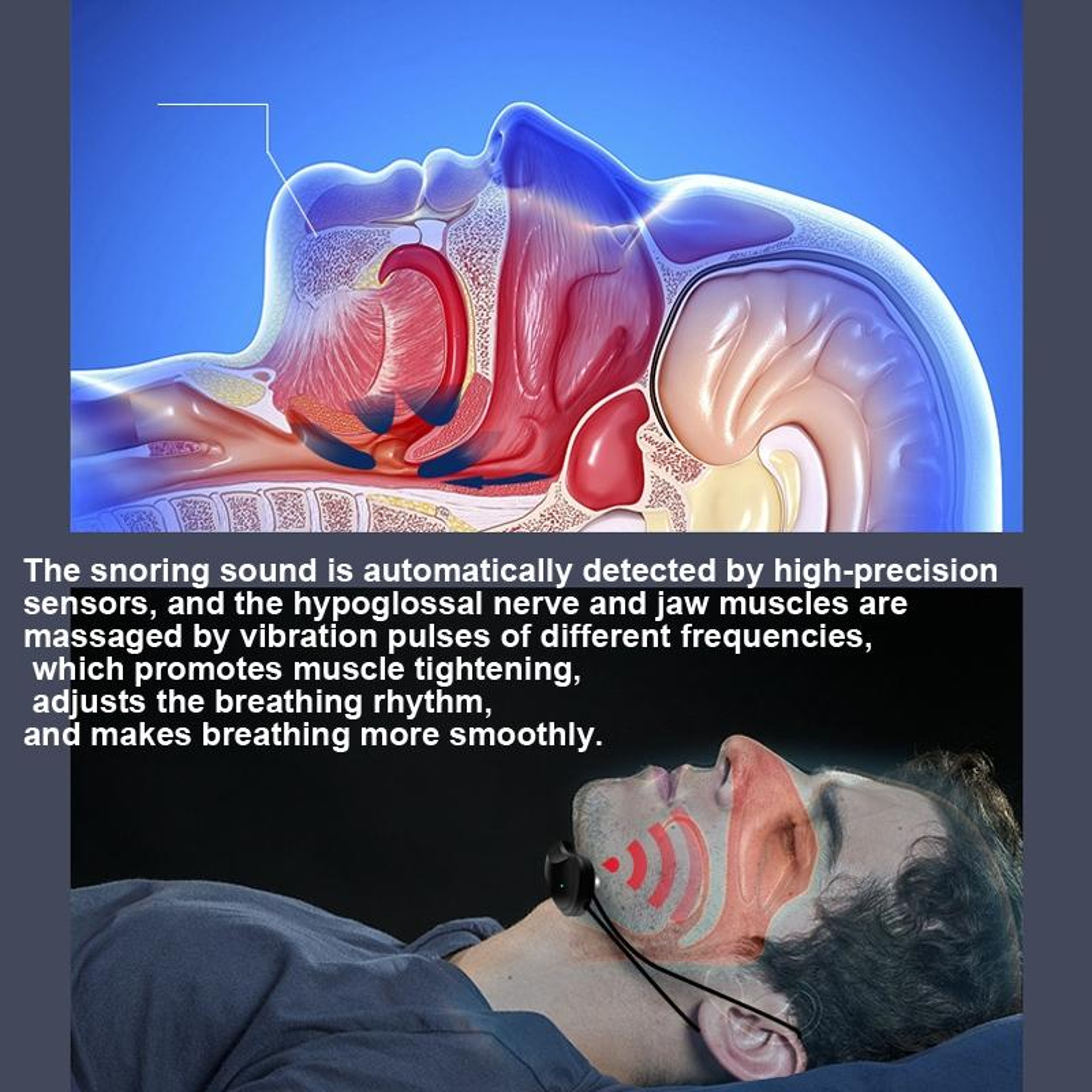 Smart USB Rechargeable Anti-Snoring Sleep Aid Device for Quiet Nights & Better Breathing – view 6