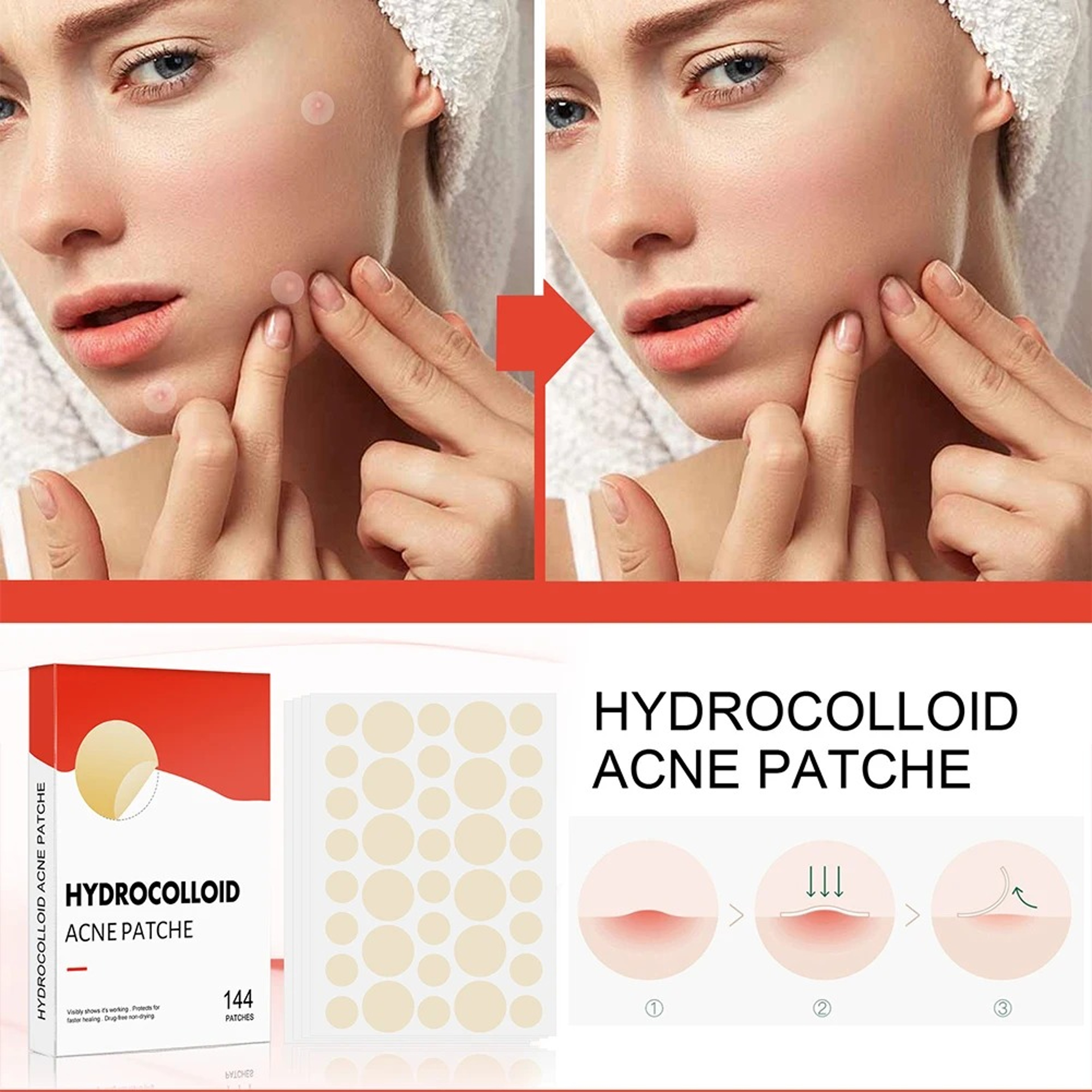 Professional Acne Patches, High-End Skin Care Pimple Stickers for Healing & Absorbing Spots – view 2