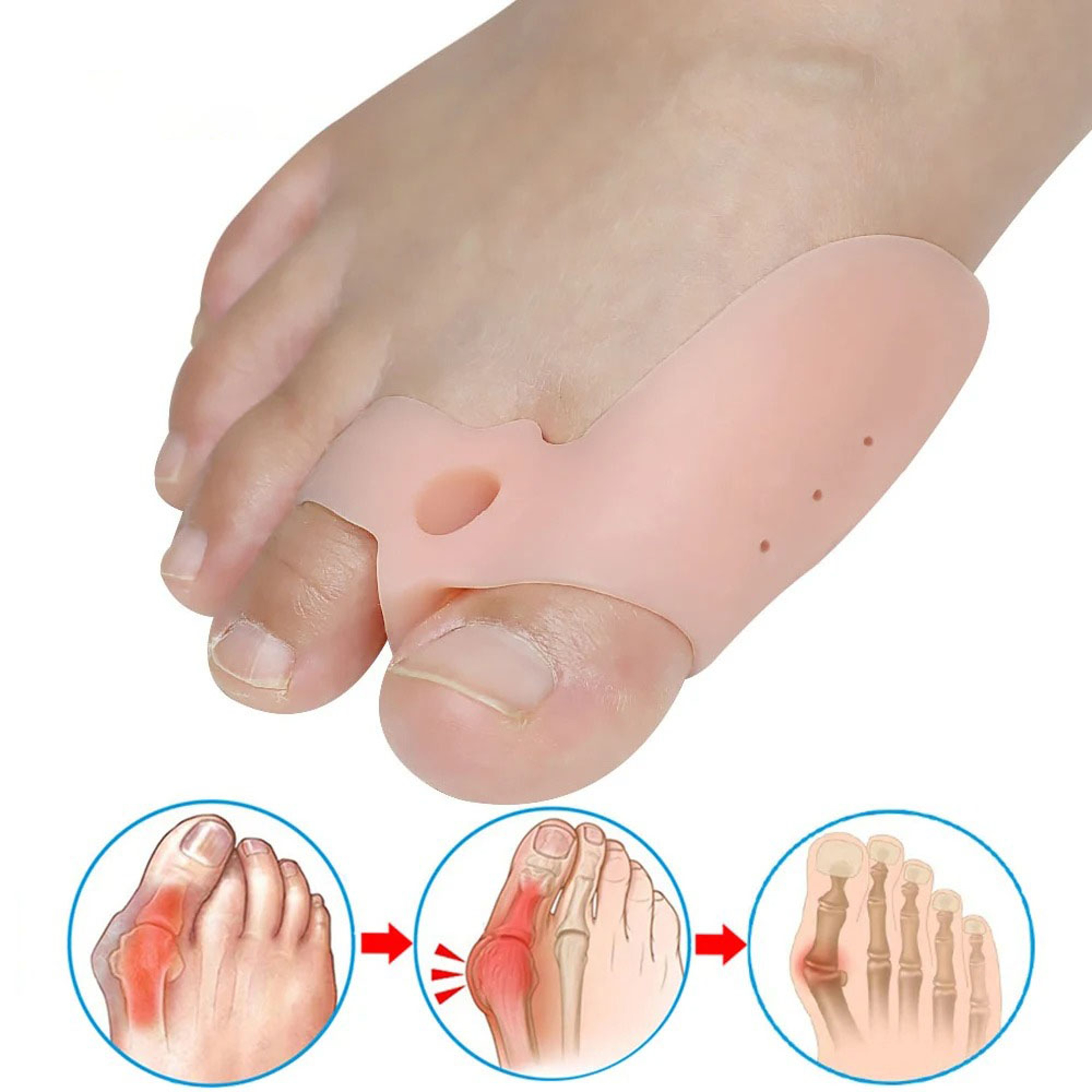 Pexmen Soft Bunion Corrector Toe Separators & Spacers for Bunion Relief Cushion Protector with Gel Shield Foot Care – view 1