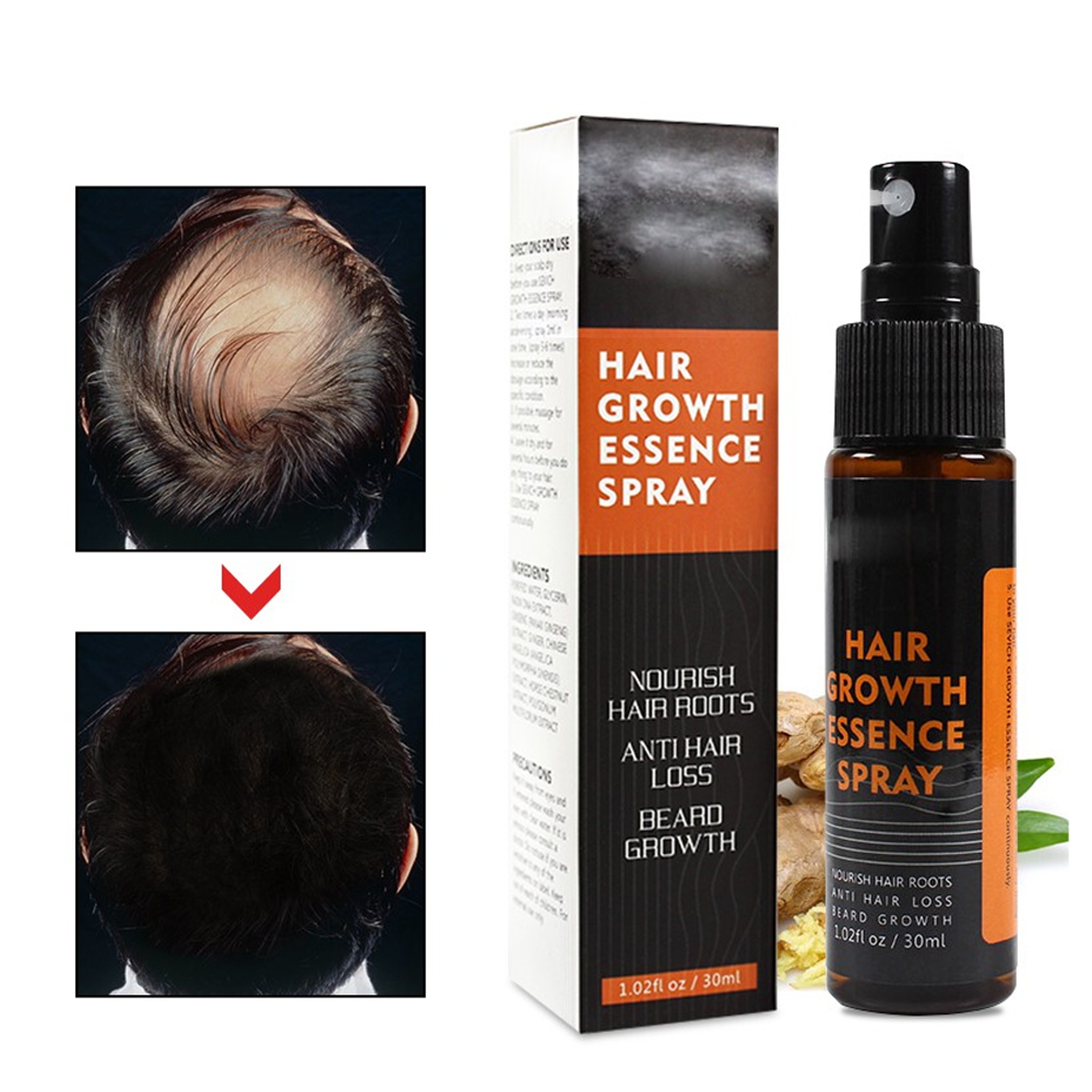 hairregrowthherbalessencespray4 (1).png