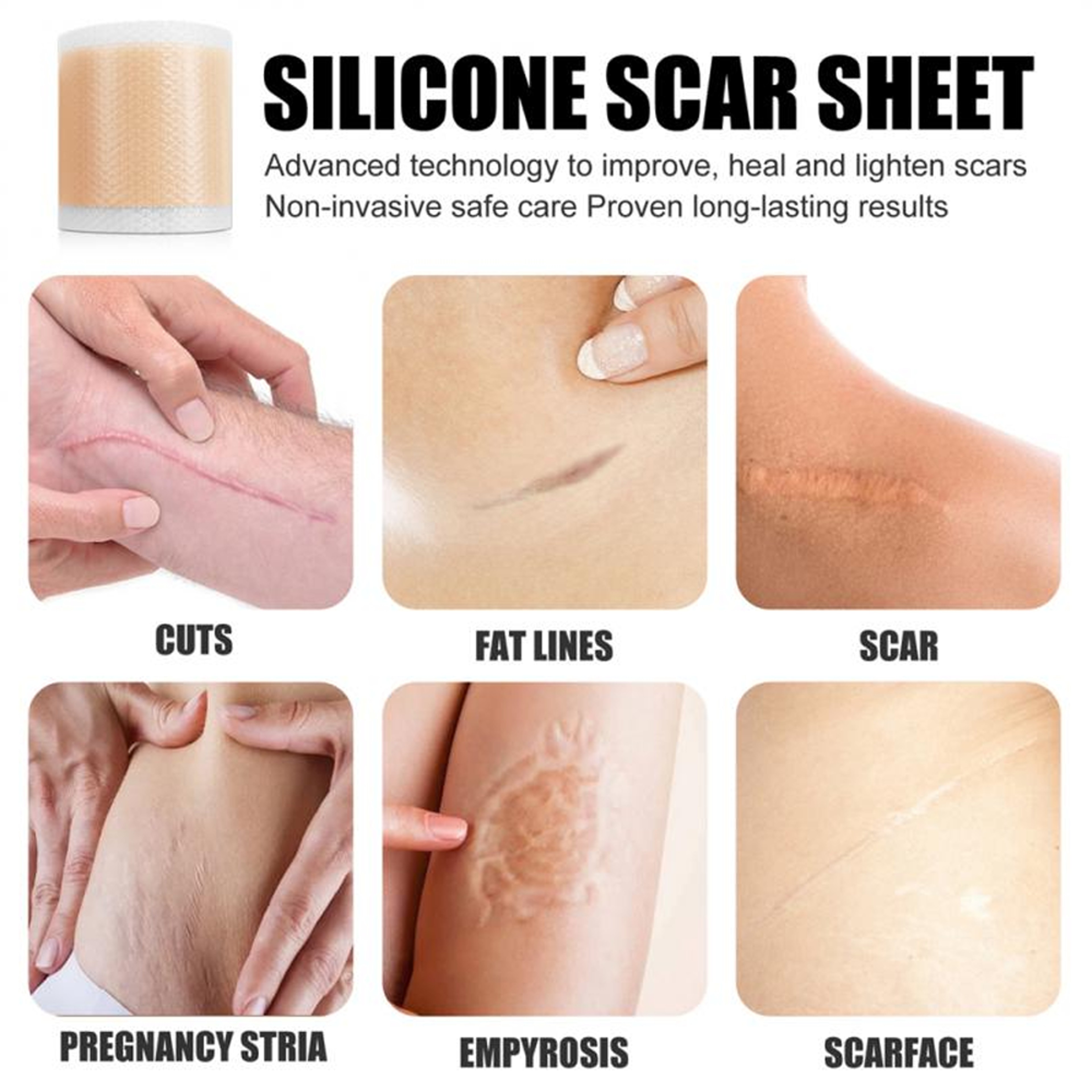 Hypoallergenic silicone tape for sensitive skin