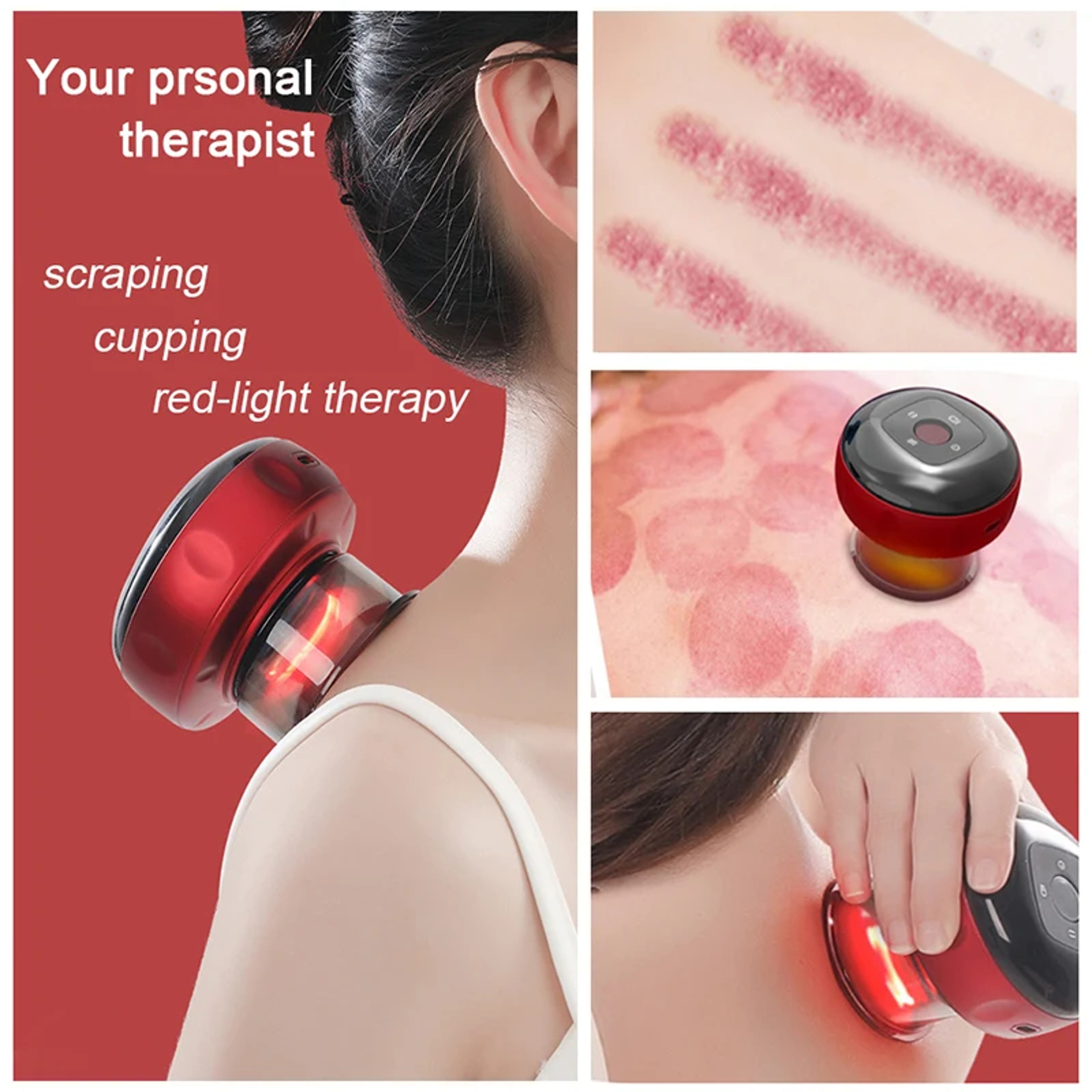 Smart Electric Cupping Massager with Heat 12 Level Vacuum Suction for Muscle Relaxation – view 2