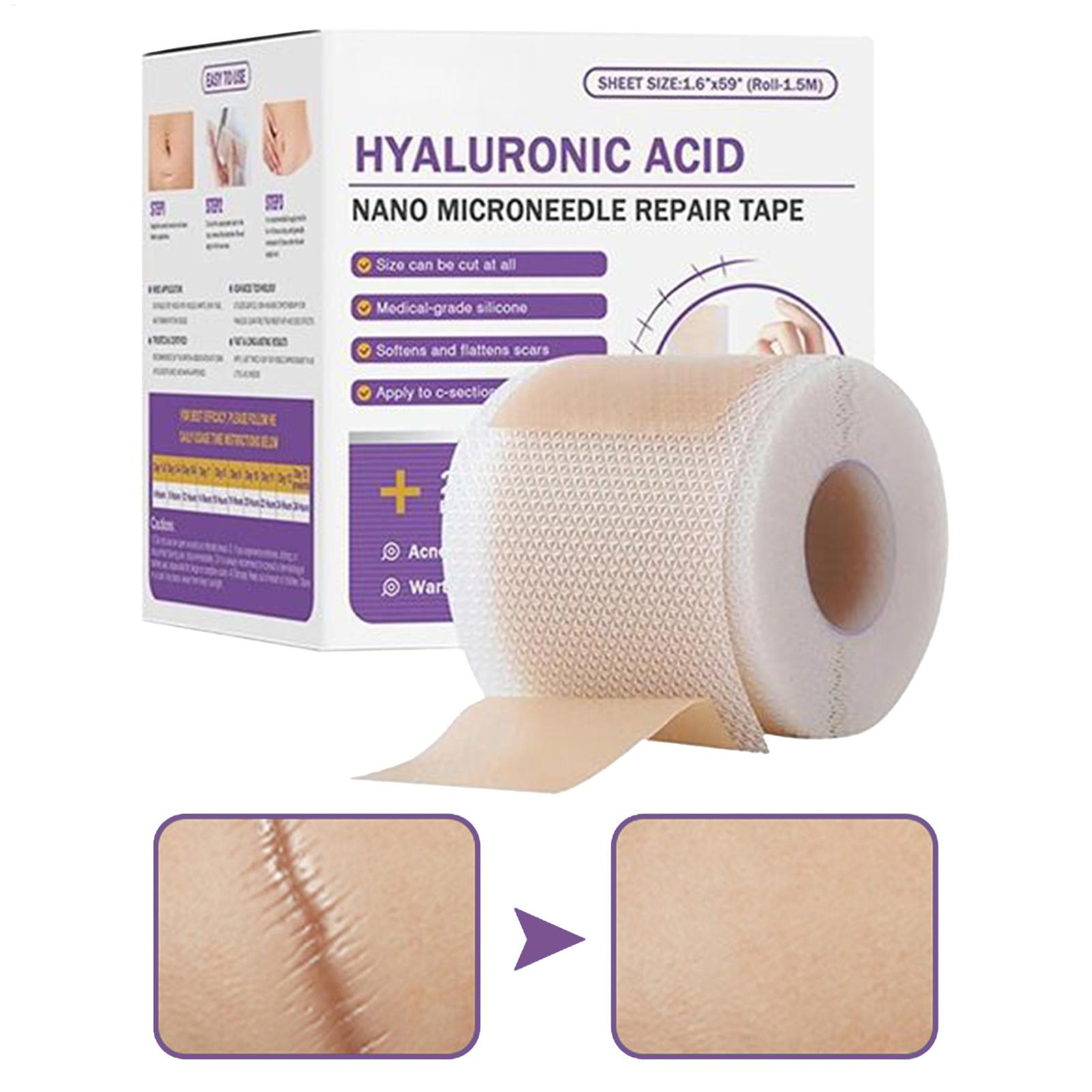 Advanced Surgical Soft Silicone Scar Patch for Acne, Burn & Trauma Skin Repair – view 6