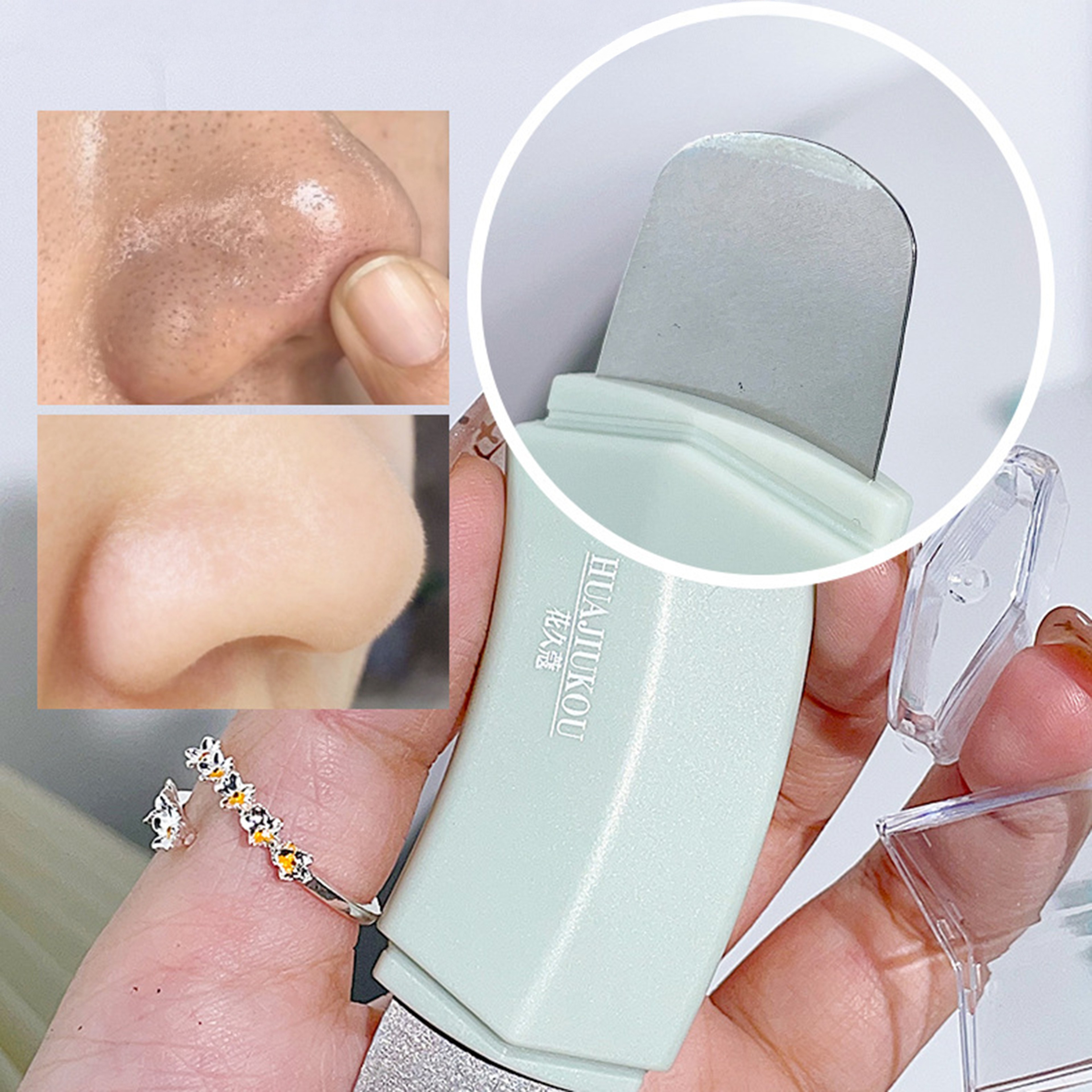 ClearGlow Blackhead Remover Tool For Deep Pore Cleansing  Whitehead Extraction 4