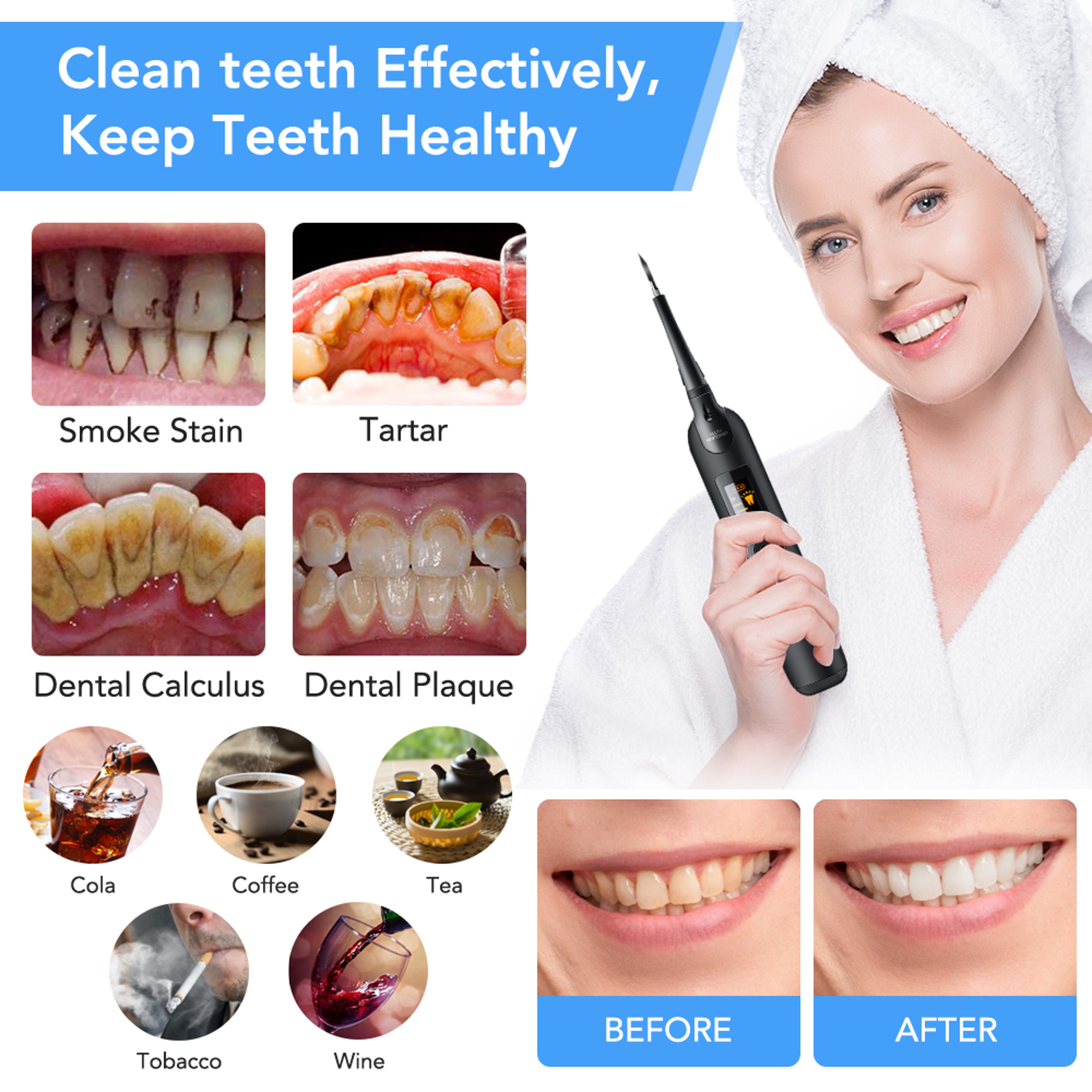 Electric Sonic Dental Scaler Calculus Stains Remover Tooth Cleaner Kit For Teeth Whitening  Oral Ca 3