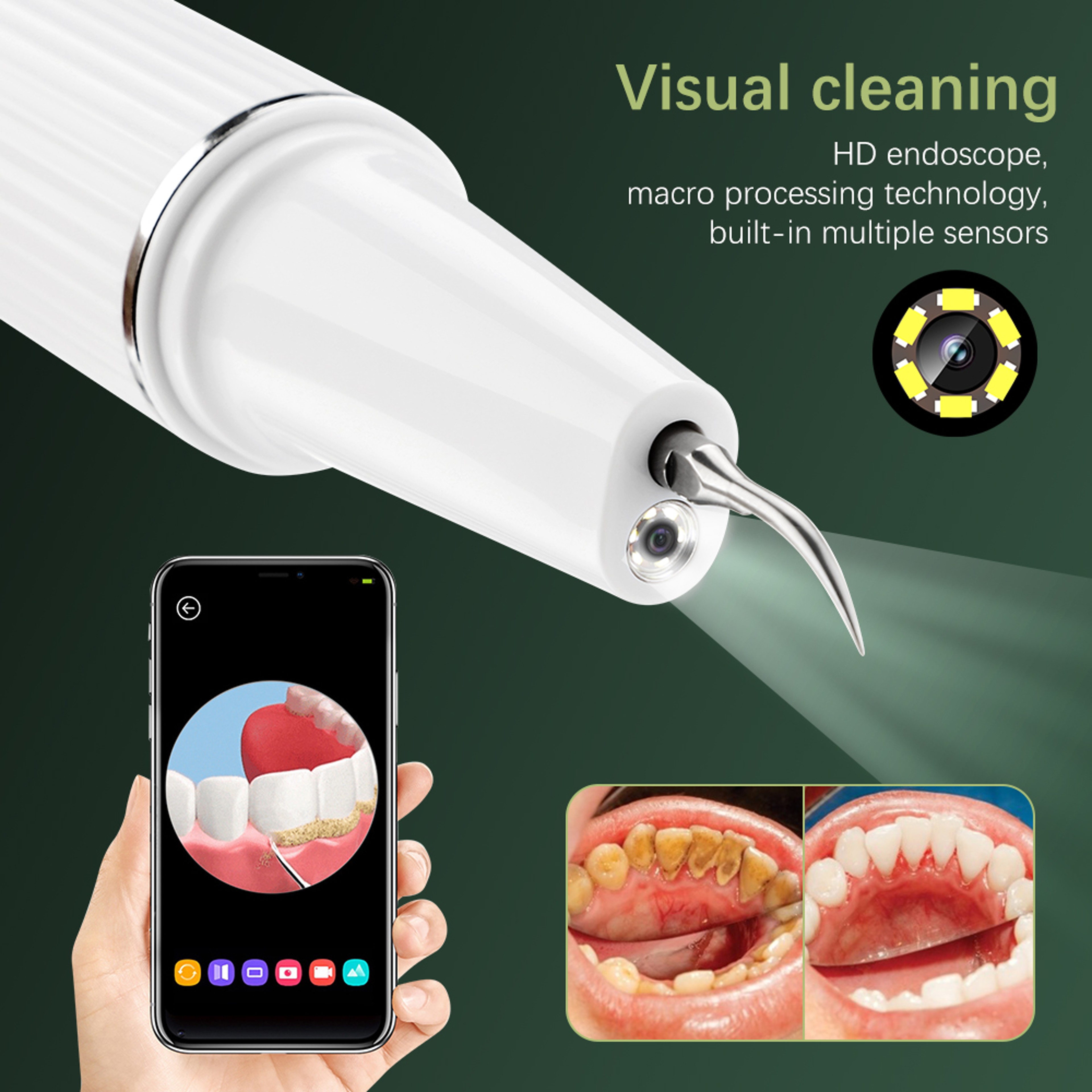 Portable Electric Ultrasonic Visual Scaler Dental Tartar Remover For Household Use 3