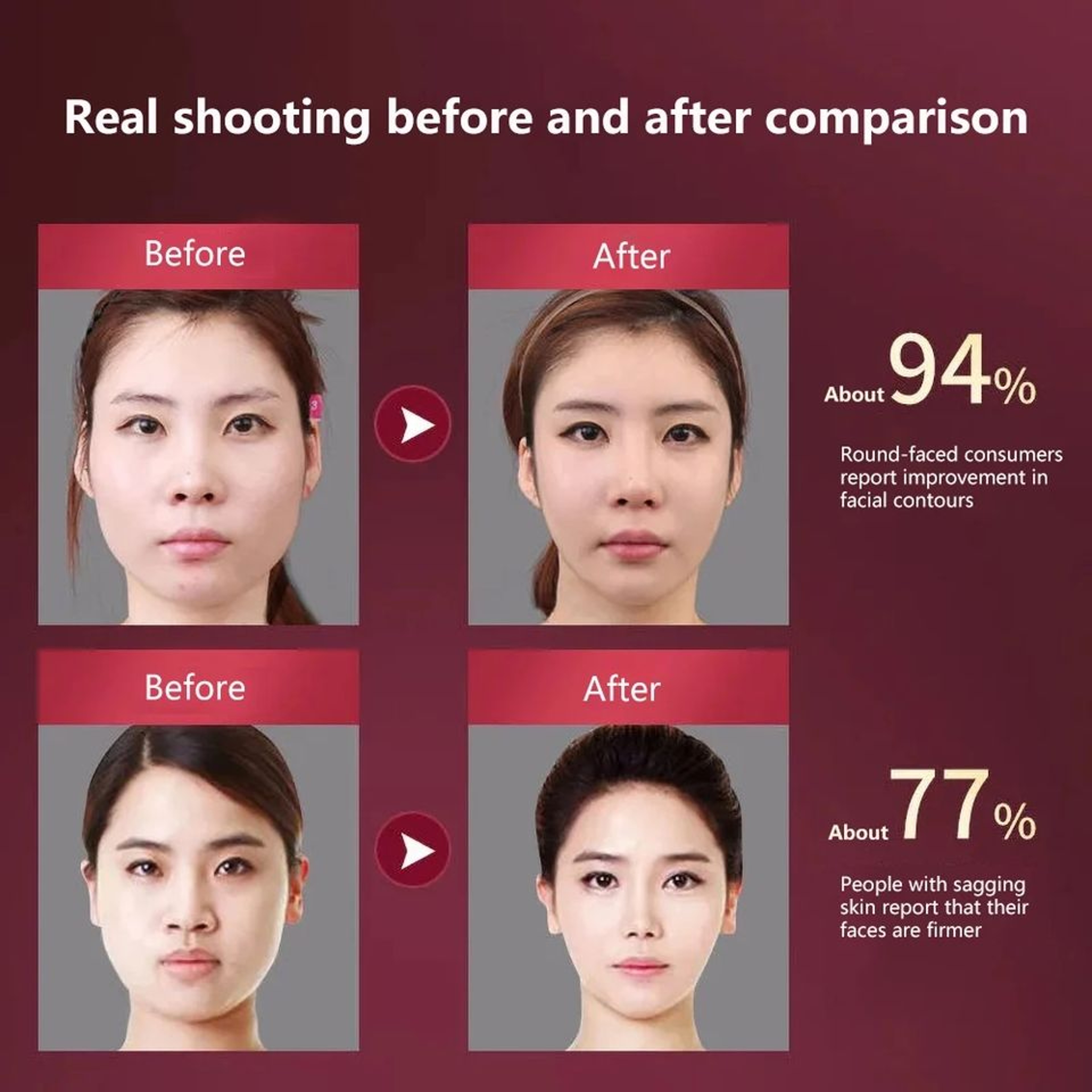 LED Photon Therapy Facial Massager For Slimming  Lifting 6
