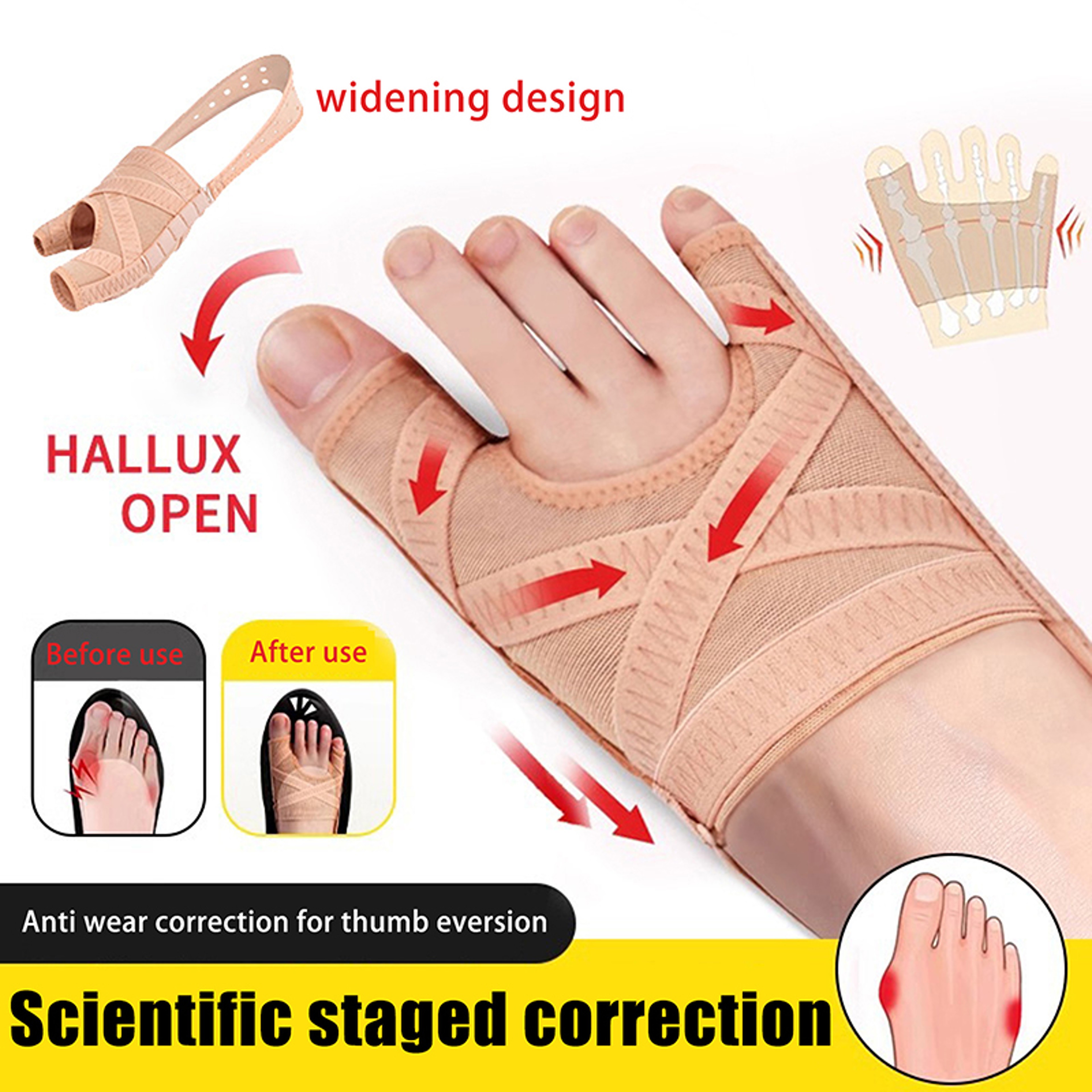 Adjustable Bunion Corrector Toe Separator Sleeve For AllDay Foot Pain Relief 1