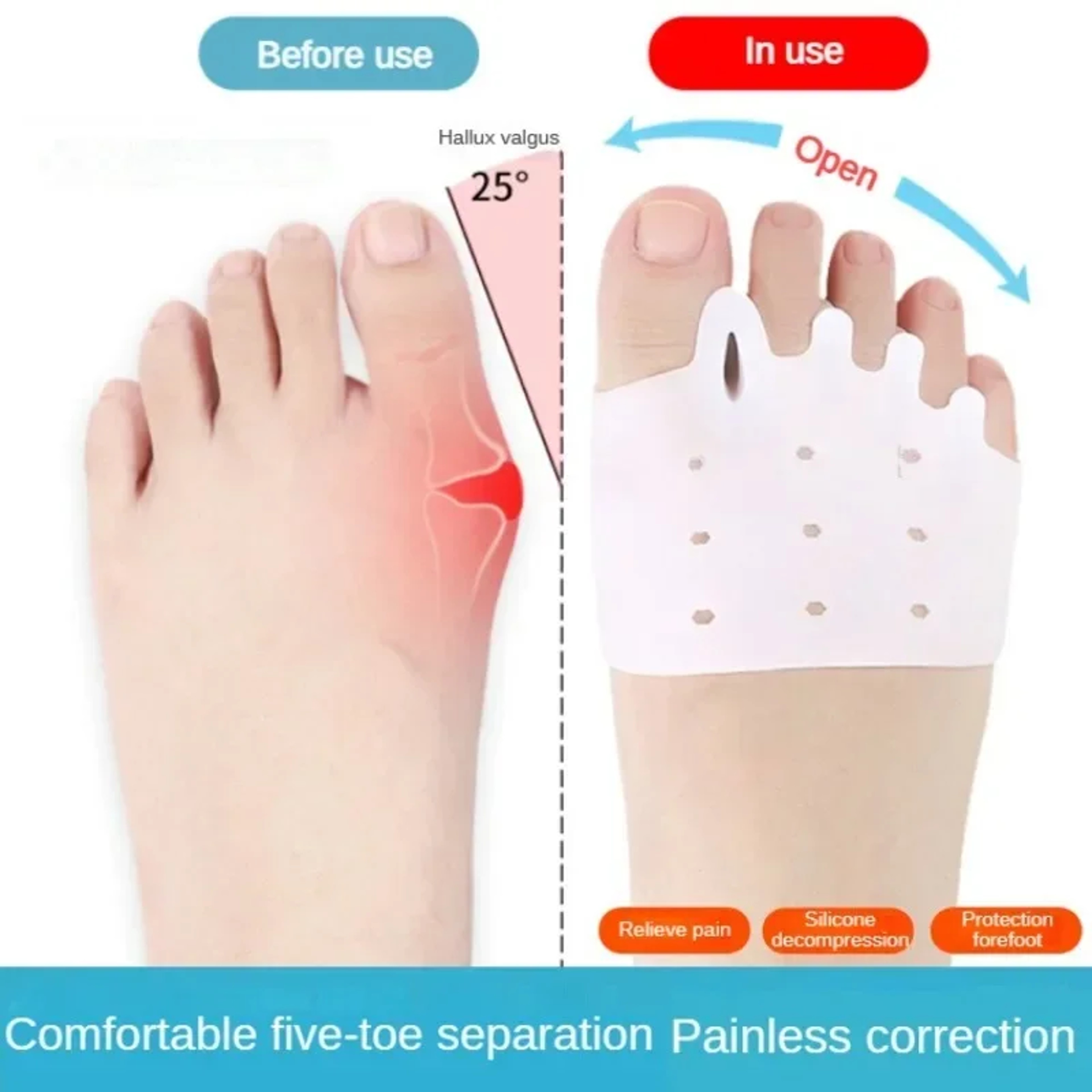Toe Separator and Bunion Corrector for Gentle Foot Support – view 2