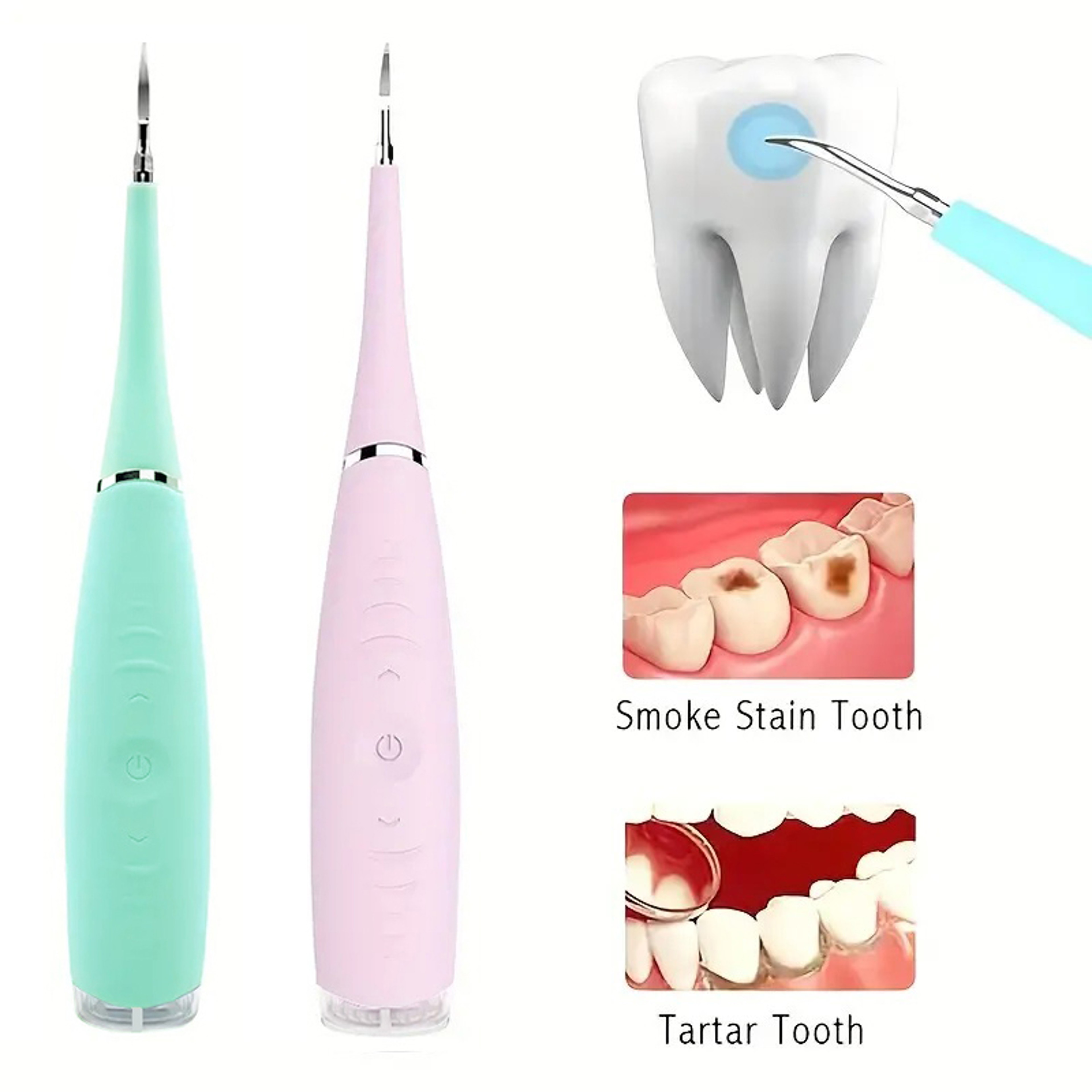 Home Dental Care Tools Electric Teeth Cleaner Teeth Instrument Teeth Stone Remover 2