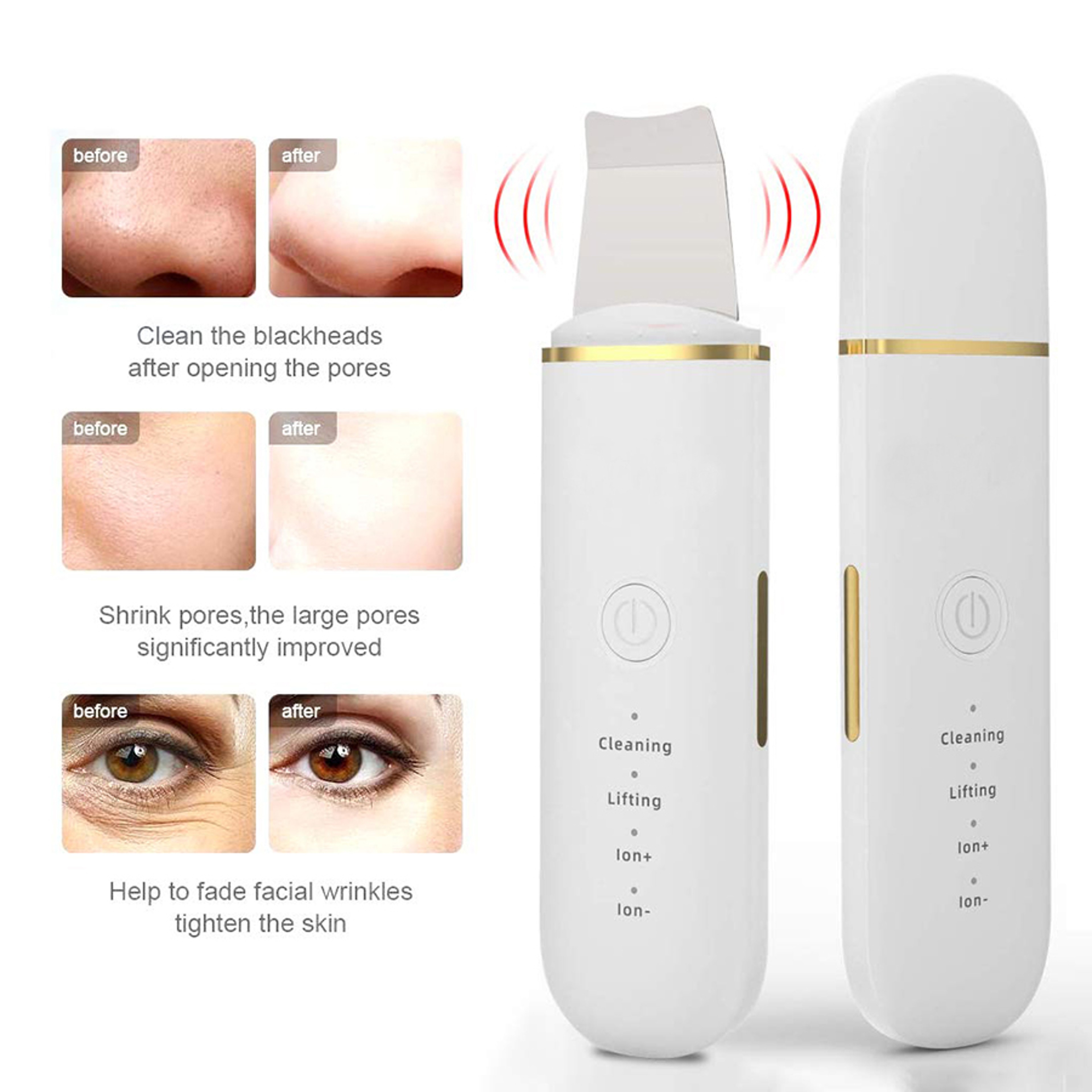 Facial Skin Cleansing Ultrasonic Skin Scrub Skincare Tools Pore Blackhead Cleaning Machine Deep Fac 4