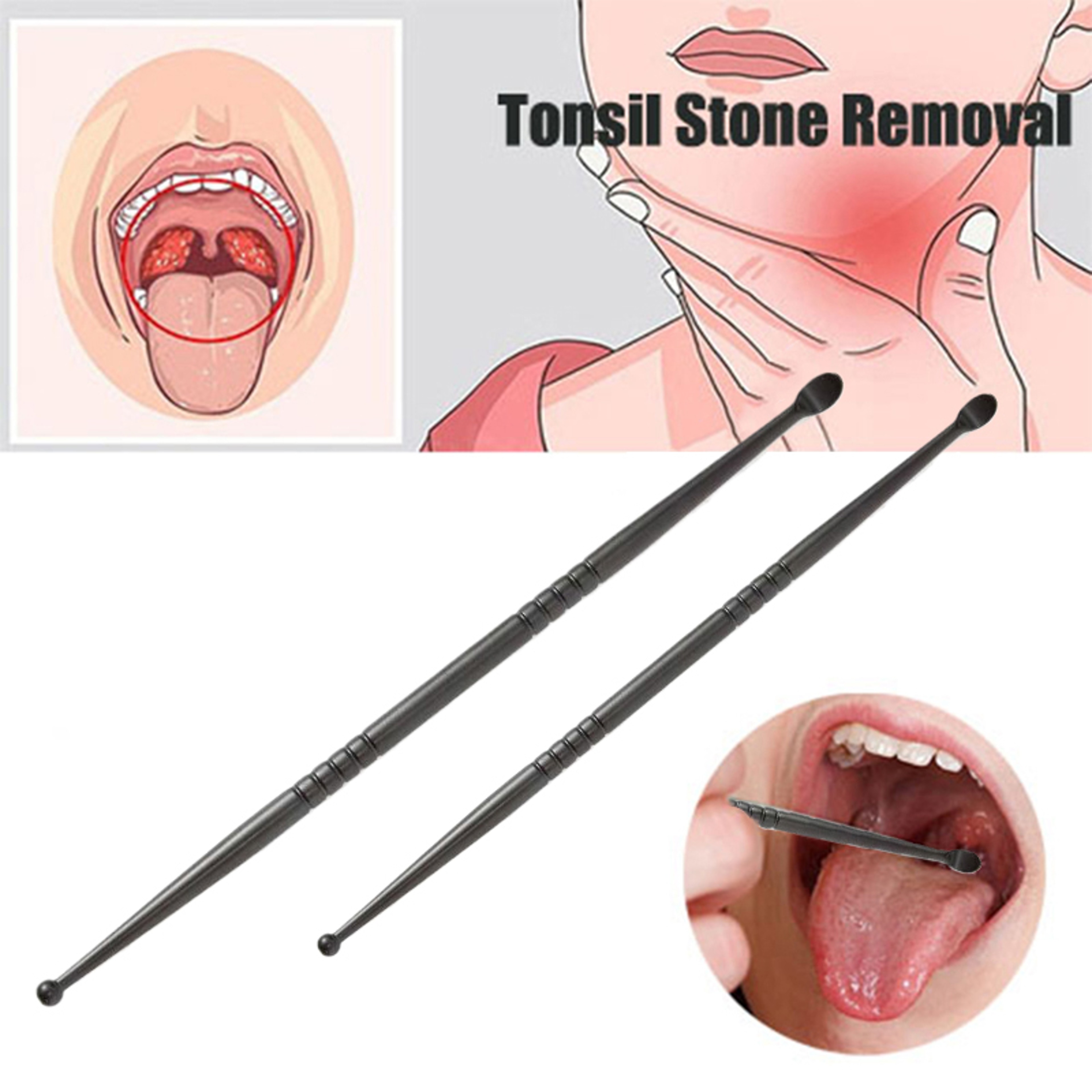 Stainless Steel Tonsil Stone Removal, 1pcs Ear Wax Remover, Mouth Cleaning Care Tools, Health Care – view 1