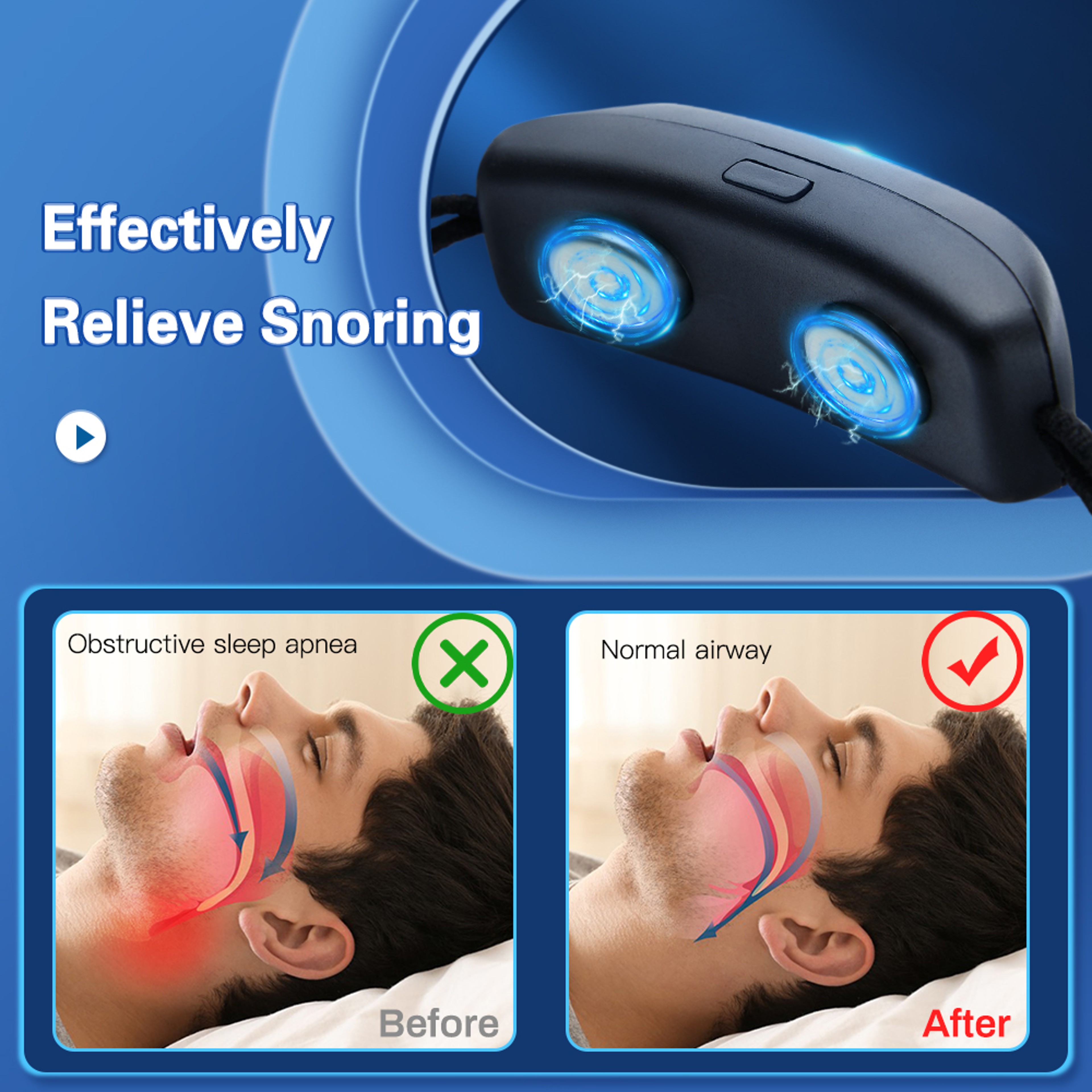 Sleep Well Stop Snore Device EMS Pulse Comfortable Aid Smart USB Anti Snoring Sleep Apnea Health Ca