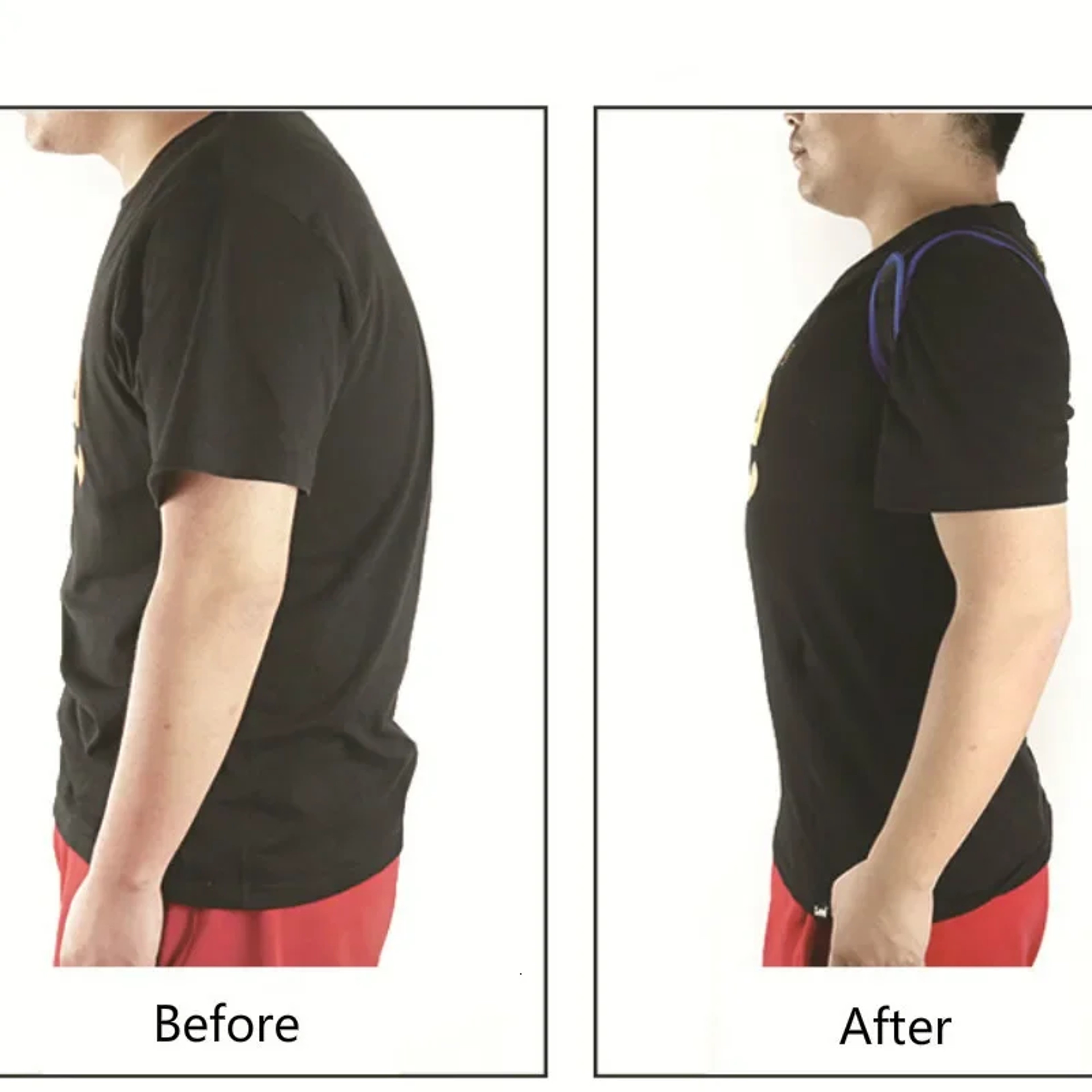 Adjustable Shoulder Brace Straight Holder, Invisible Back Posture Corrector Trainer, Clavicle Support for Adults – view 4
