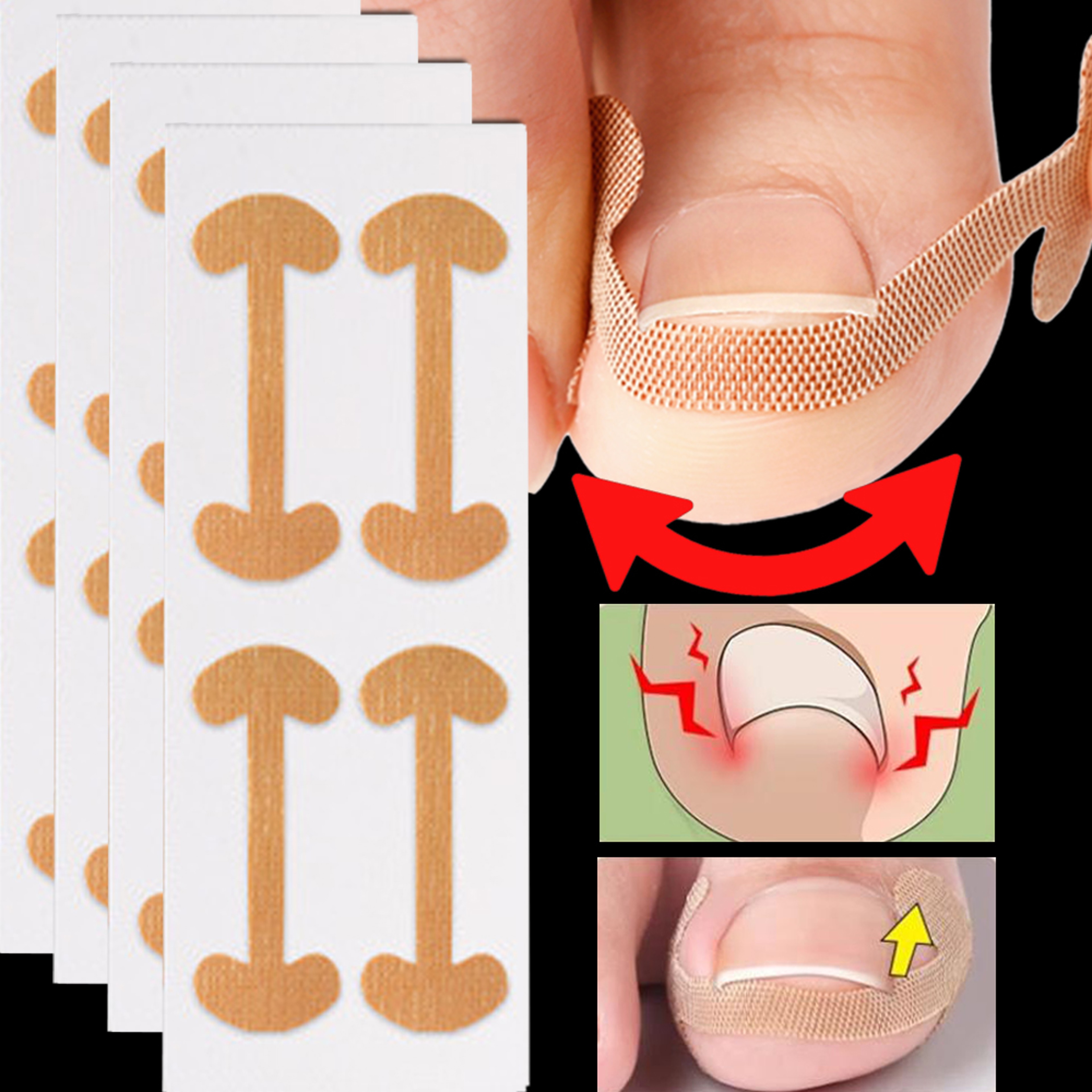 Lasting Adhesion Waterproof Nail Correction Strips, Professional Toe Care Pedicure Tools, Stickers Elasticity – view 2