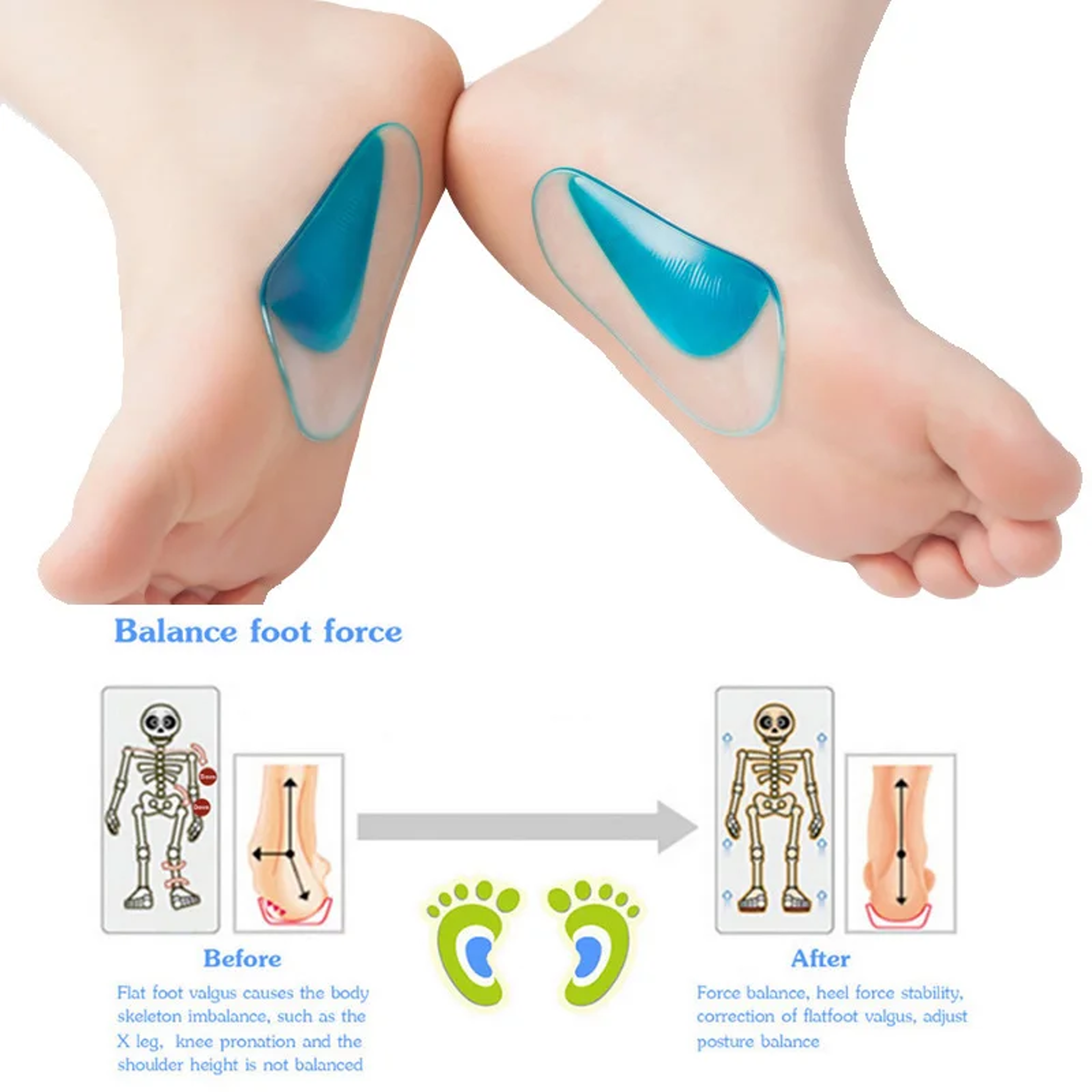 Flat Foot Corrector Insole, Silicone Gel Arch Support, Professional Orthotic Shoe Cushion for Foot Alignment – view 2