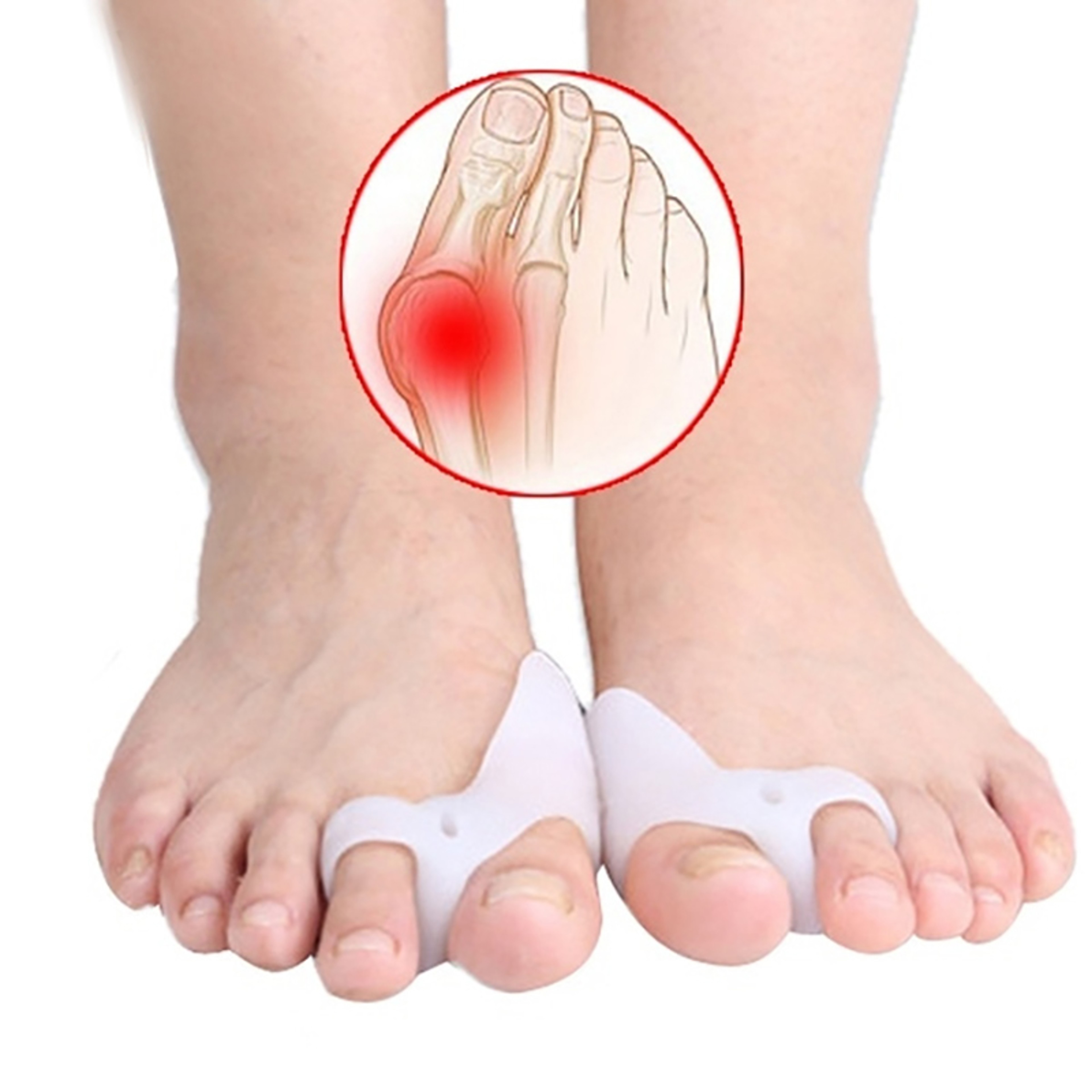 Toe Separator Hallux Valgus Buffer, Silicone Toe Corrector, Improve Foot Health and Comfort Instantly – view 2
