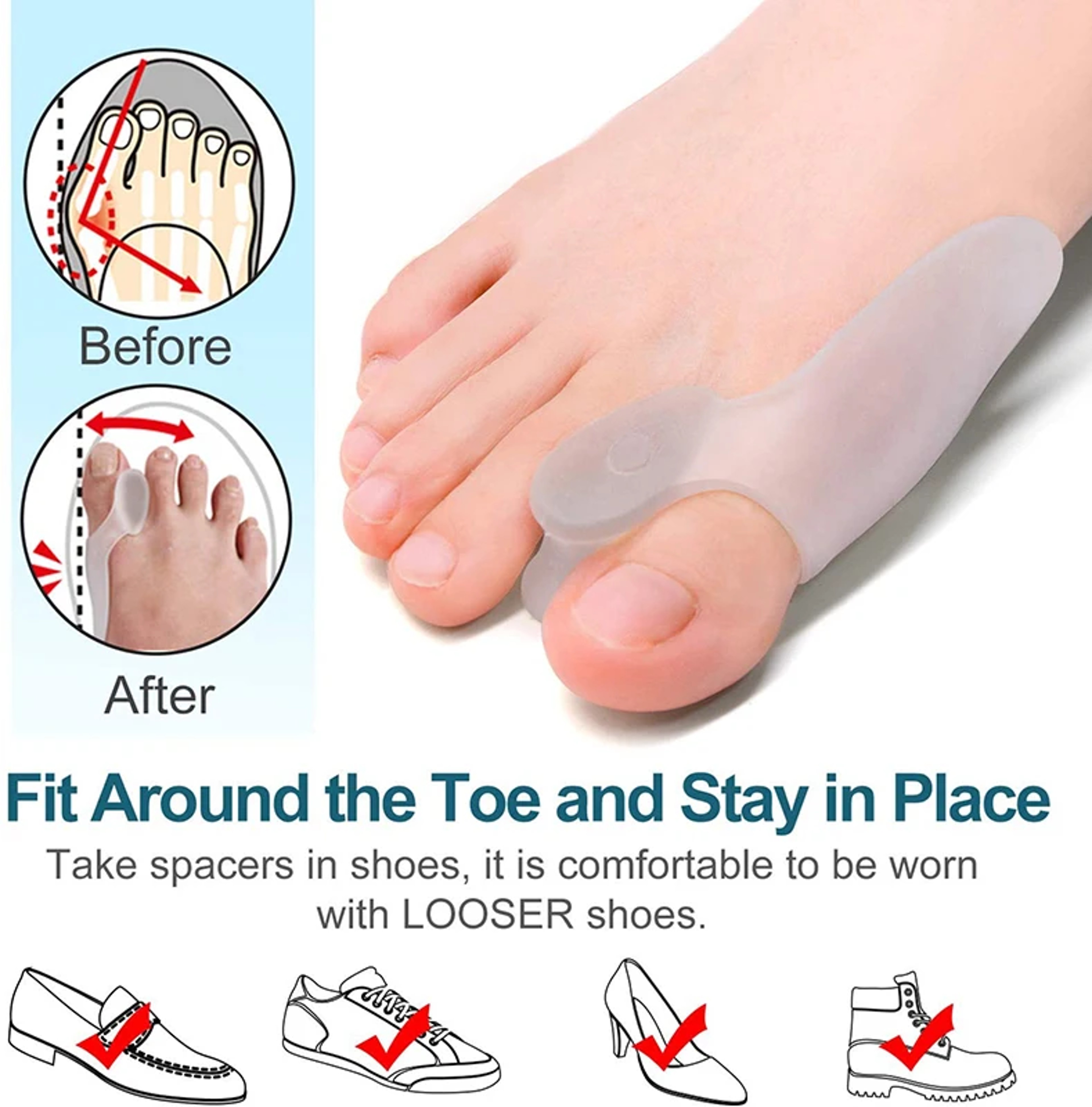 Soft Big Toe Corrector, Get Relief from Bunions for Long-term Comfort, Perfect for Night and Home Use – view 6