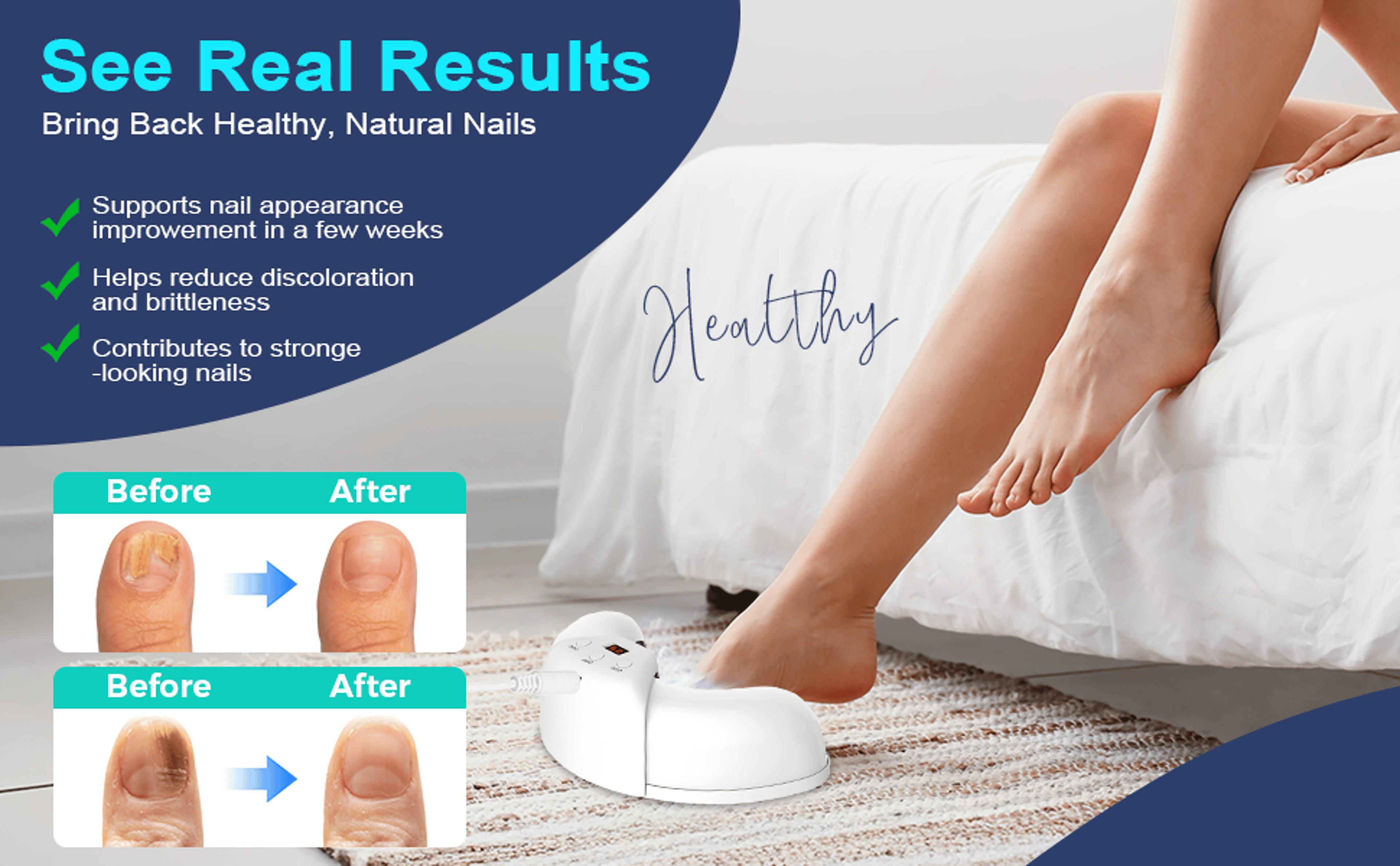 Nail Fungus Laser Therapy Device, Safe, Painless At-Home Nail Care – view 3