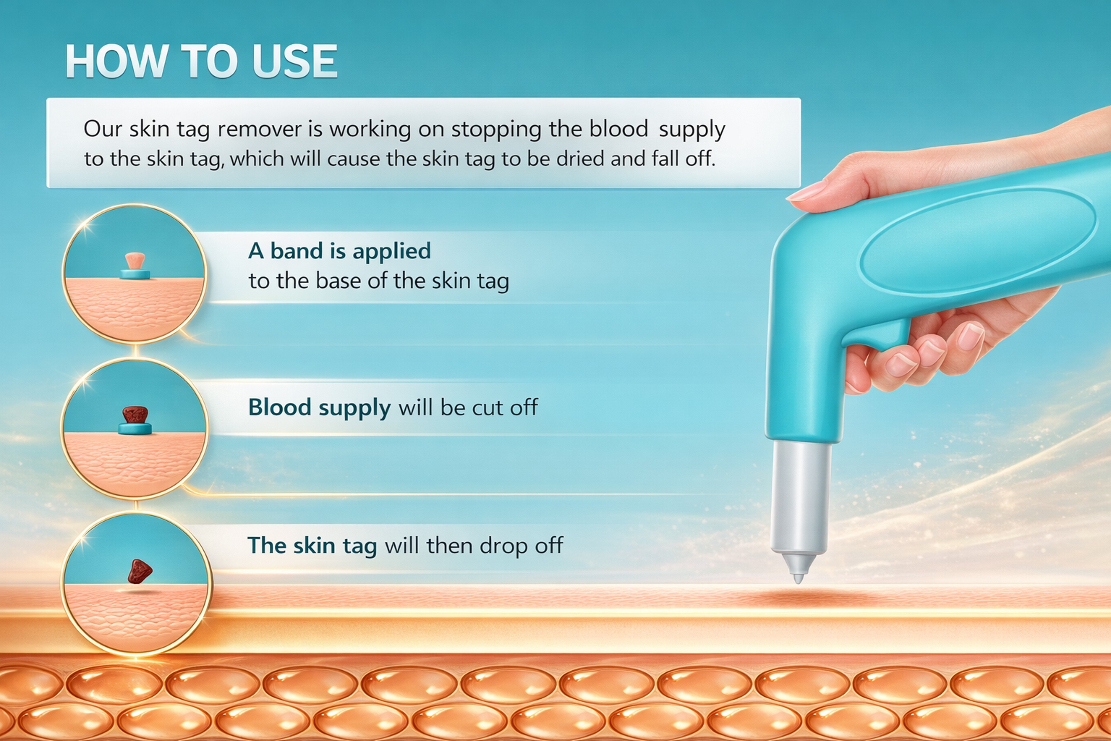 3-in-1 Skin Tag & Mole Removal Kit - Fast, Painless Treatment for Clear Skin at Home – view 11