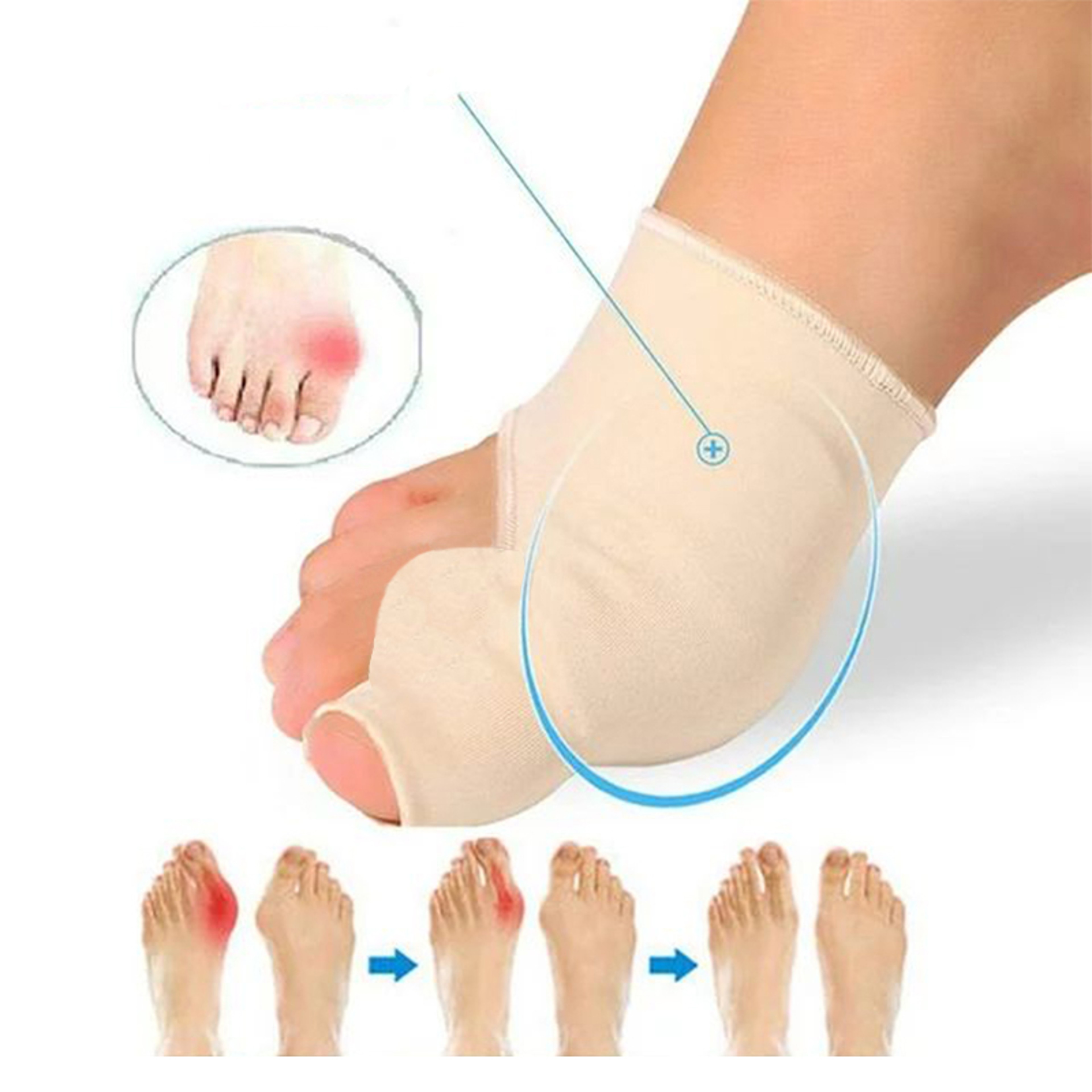 Bunion Corrector, Toes Corrector, Protector Bunion Sleeve, Big Toe Separator, Regulator Sock, Straighteners, Feet Care – view 3