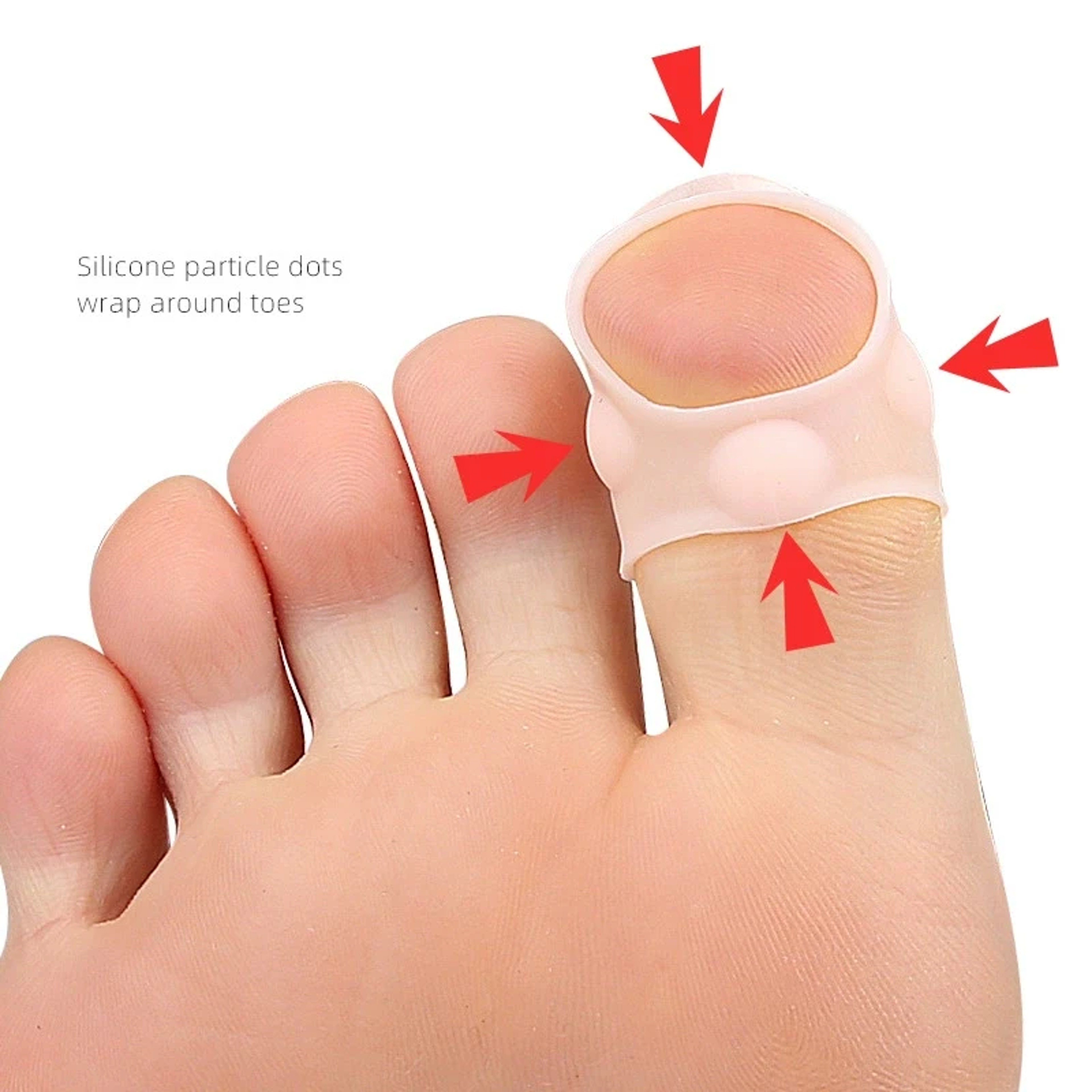 Invisible Ingrown Toenail Correction Tool, Silicone Toe Nail Cover, Elastic Straightening Clip Brace – view 2