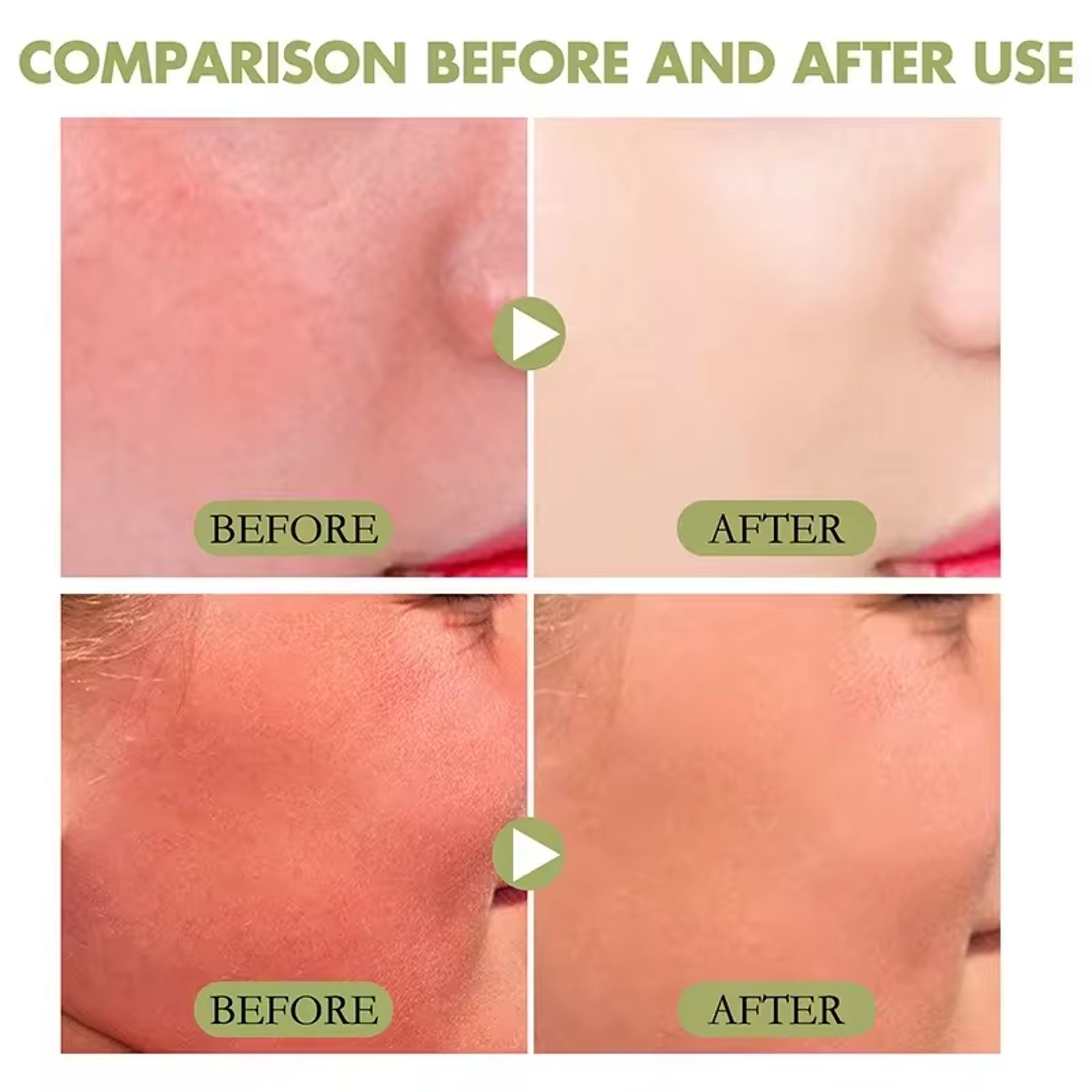 High Protection SPF Facial  Body Sunscreen Lightweight Non Greasy UV Shield 1