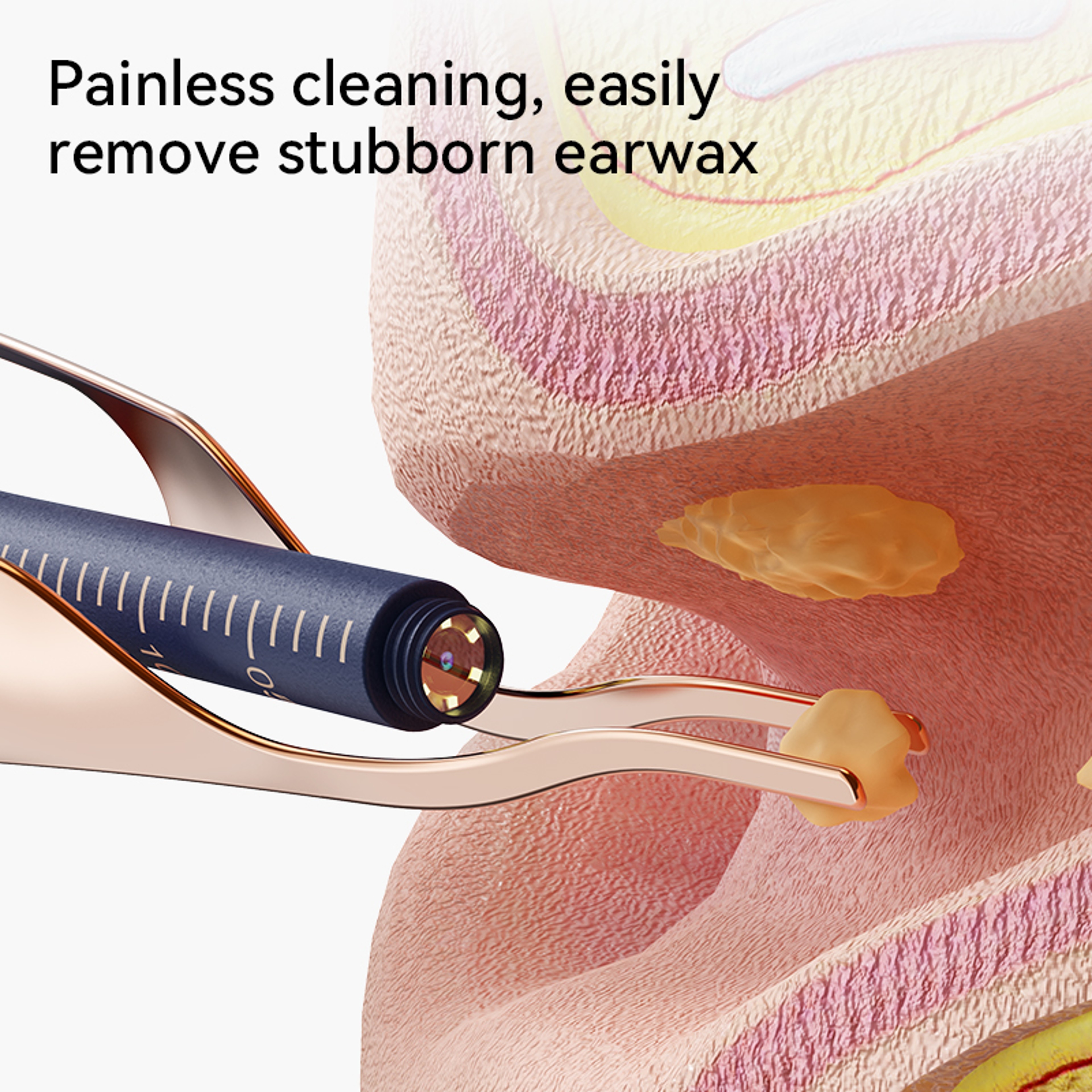 Smart Visual Ear Cleaner with Camera HD Endoscope Ear Wax Removal Tool – view 5