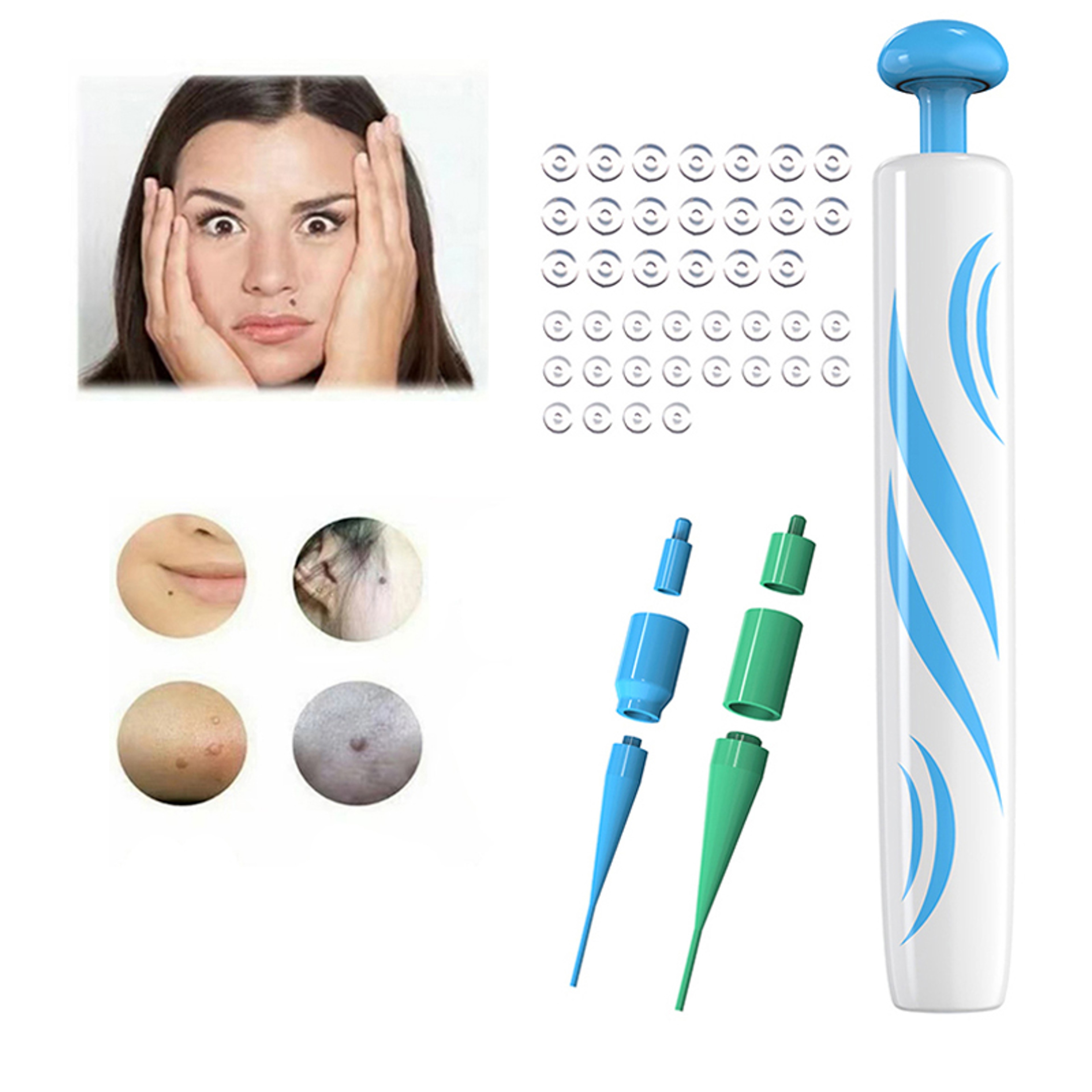 2 in 1 Auto Micro Skin Tag Remover Device Kit, Standard Face Cleaner for Adult Mole, Wart, Black Dots Remover, Painless – view 1