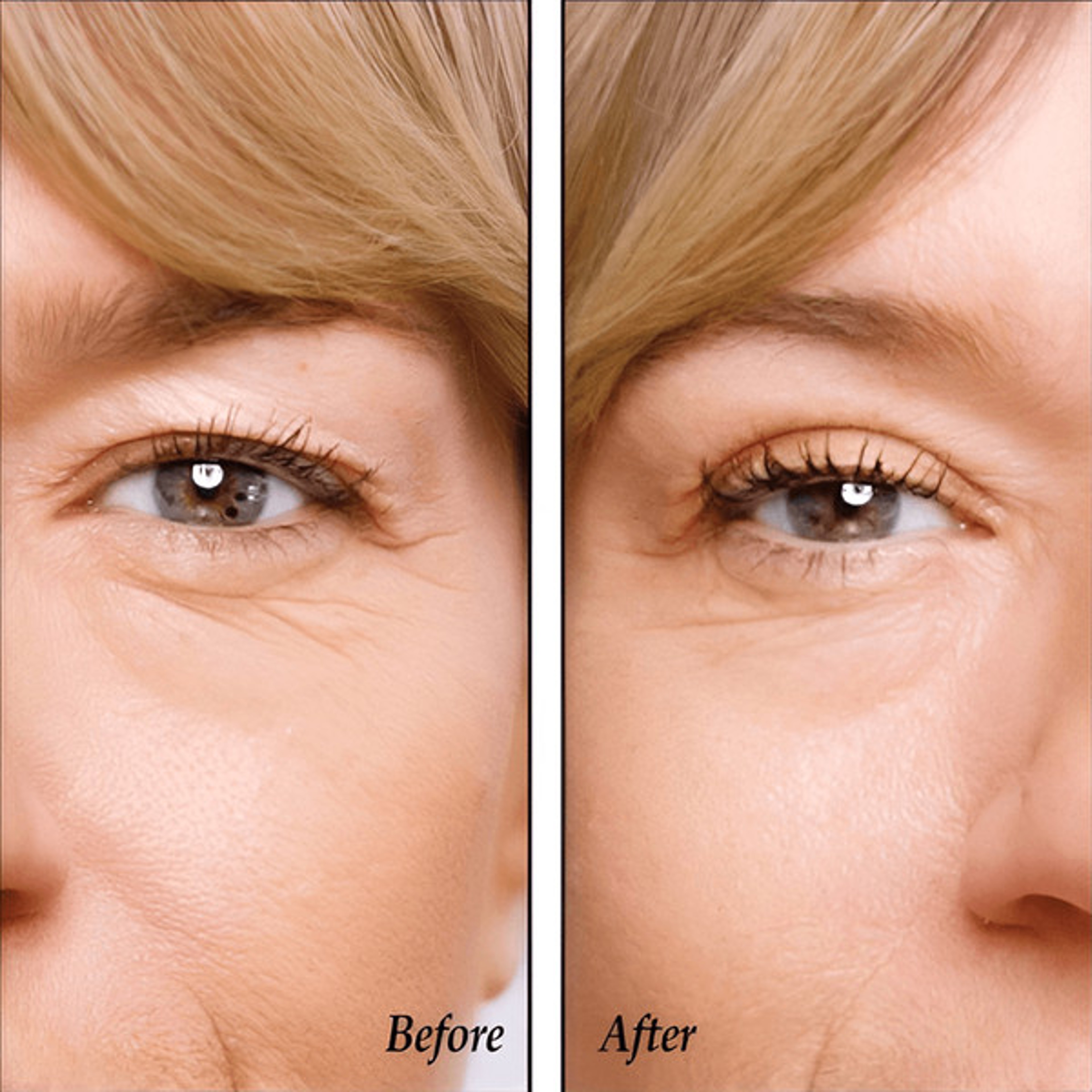 Eyelid Lifters Tape 6jpg