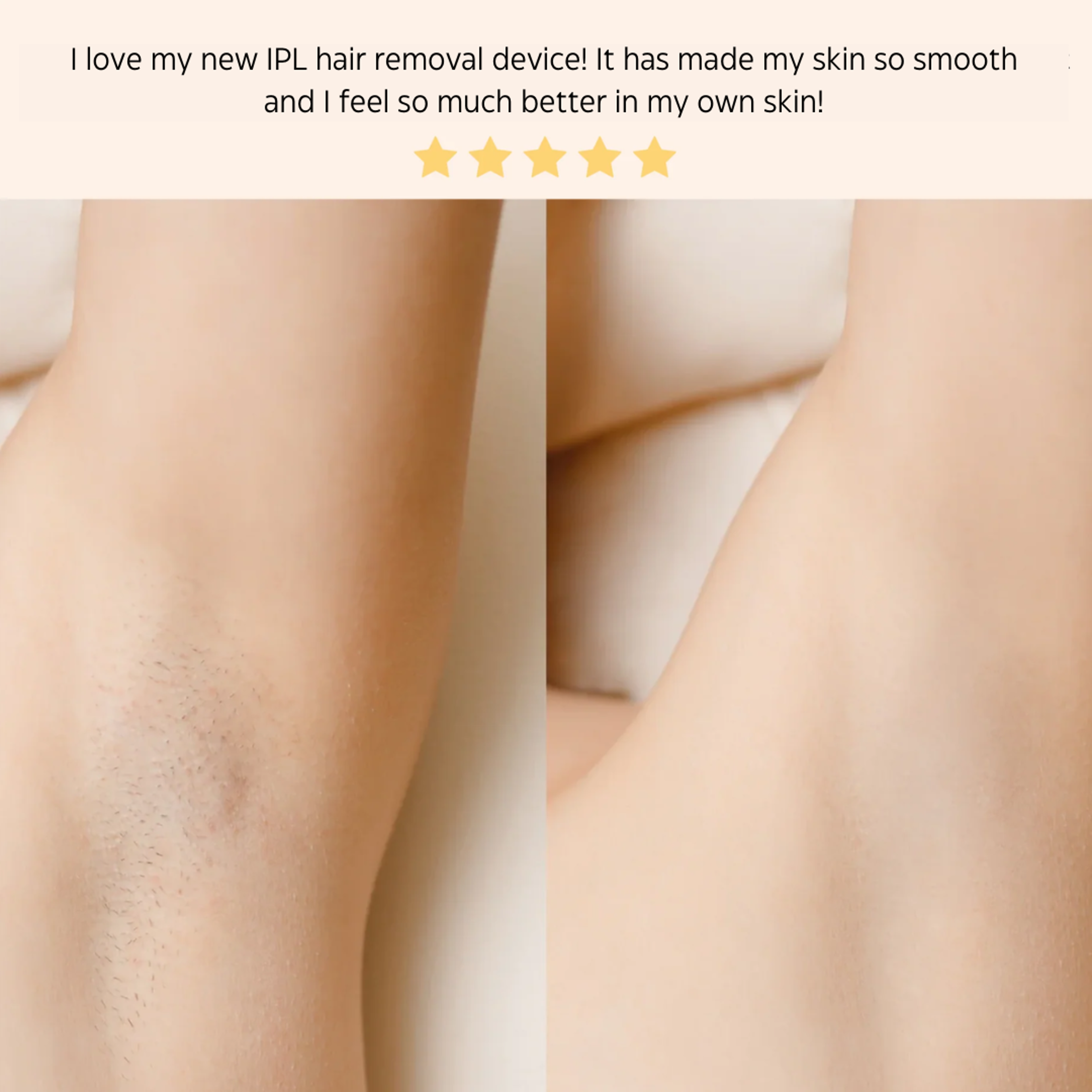 IPL Laser Hair Removal Handset System 6