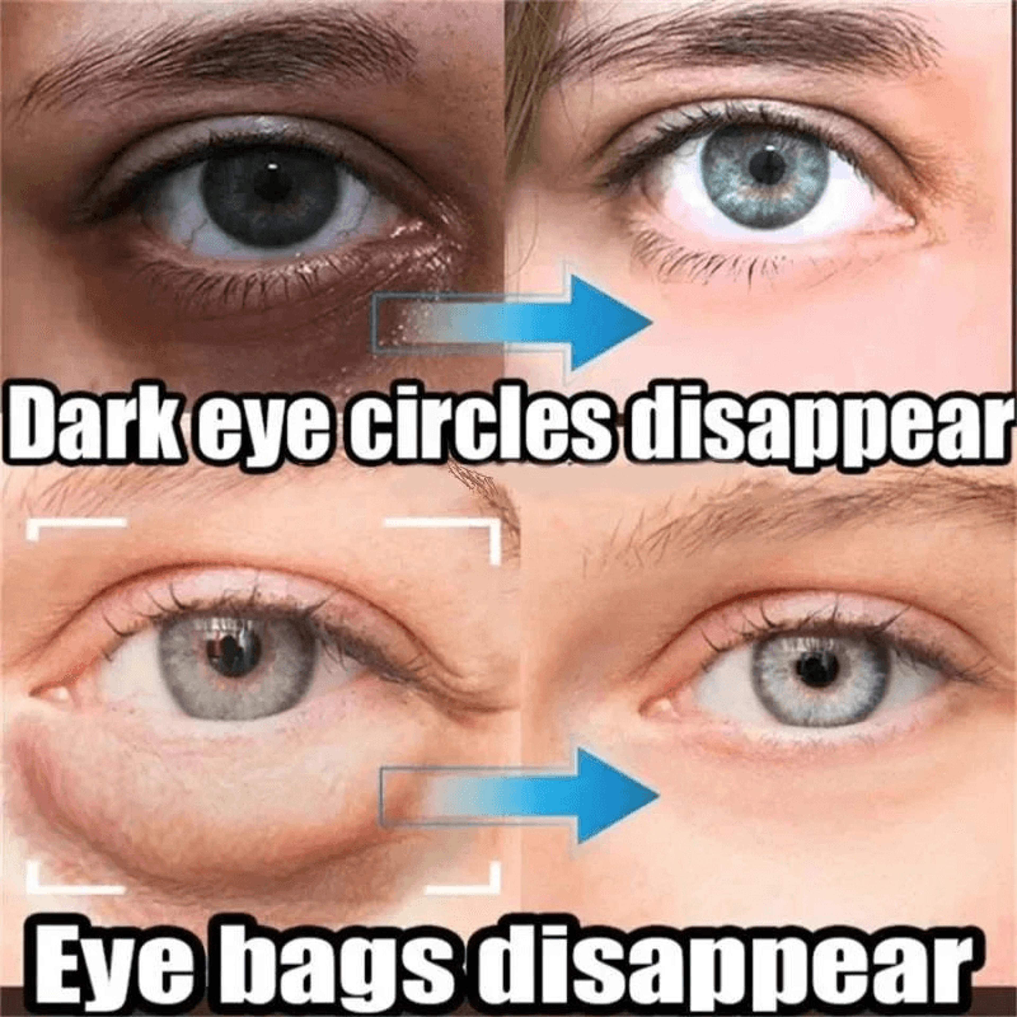 quick fix under eye cream before makeup application