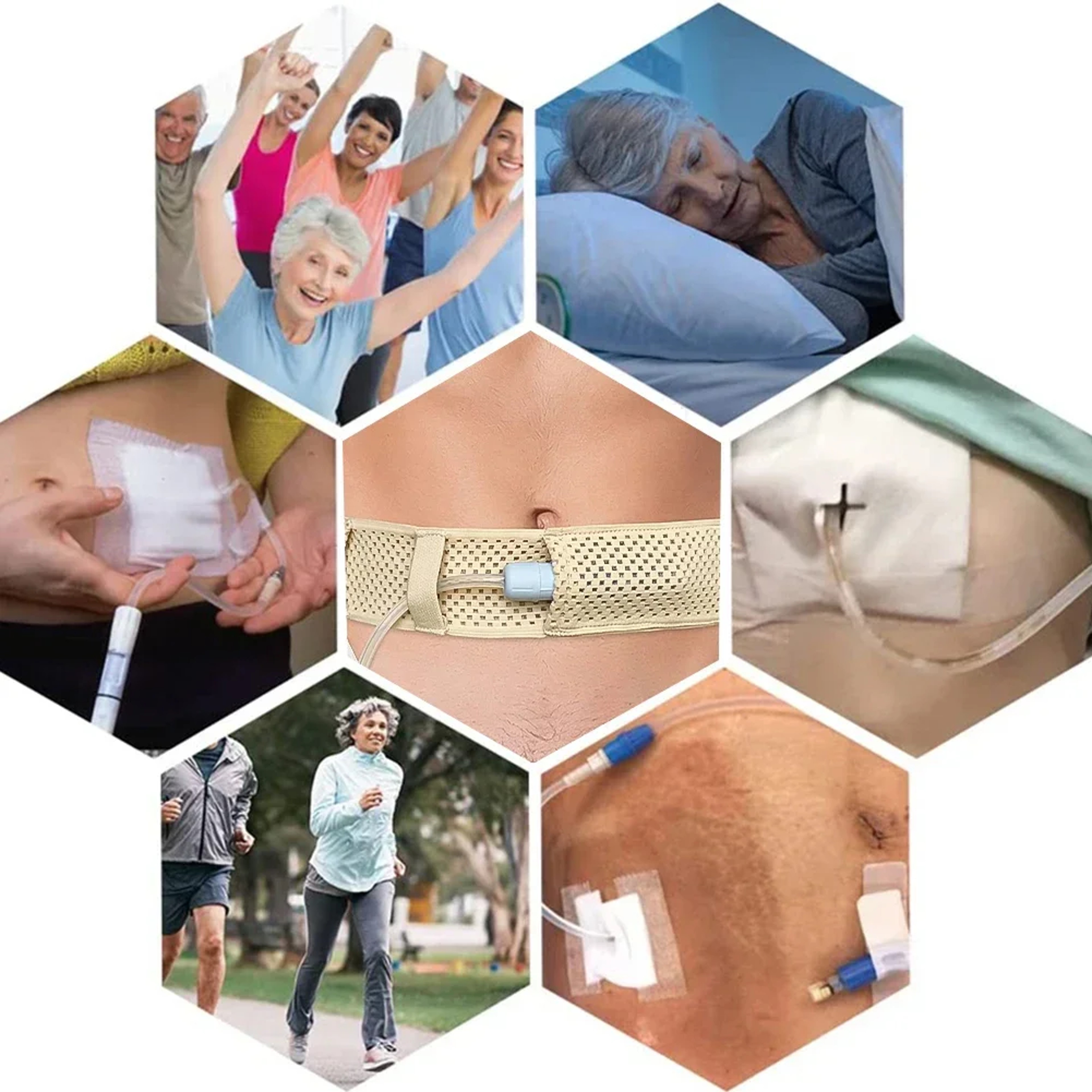Abdominal Support Belt For Secure Catheter Protection And Stabilization 8