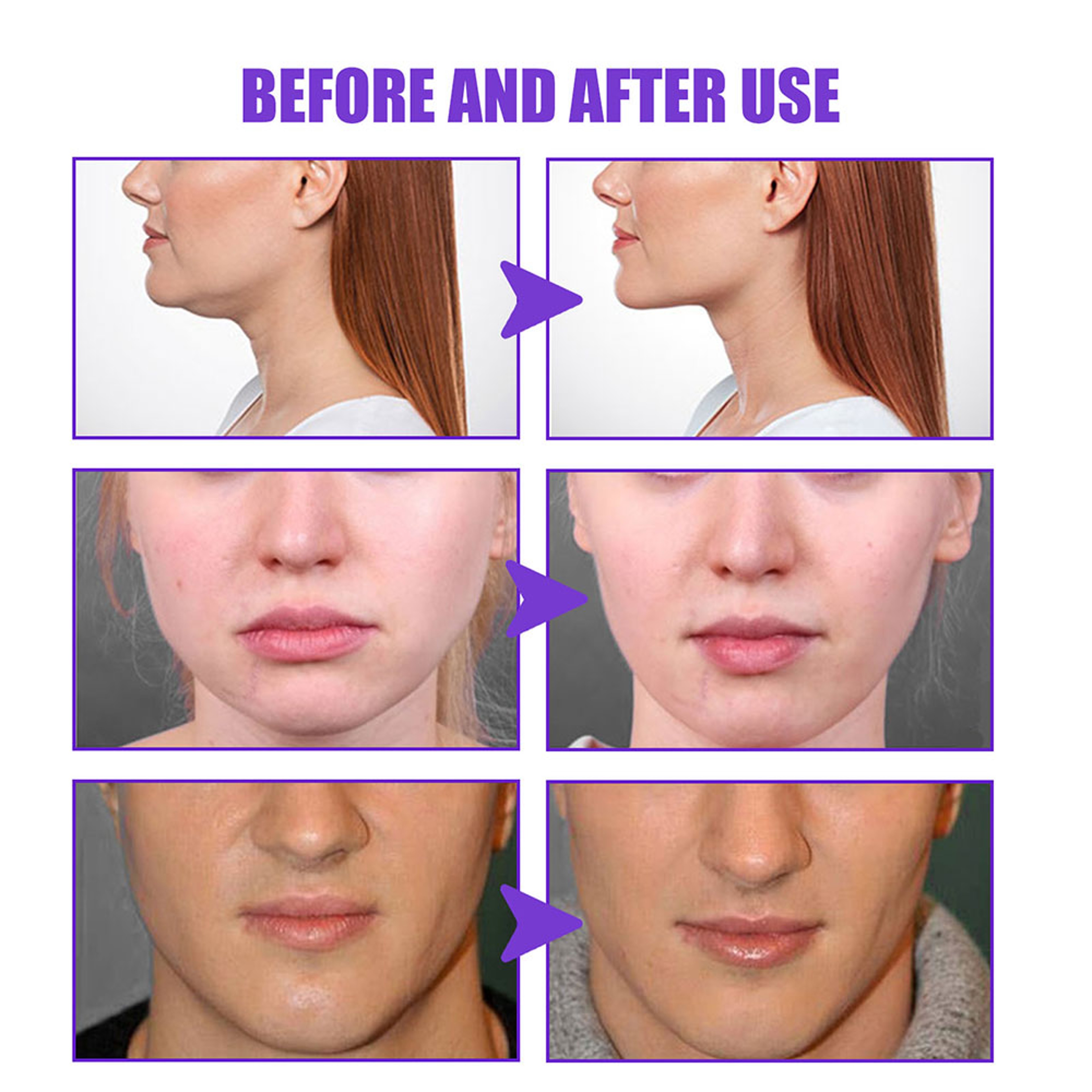 AntiWrinkle Firming Facelift Cream Masseter Muscle Slimming Double Chin Fat Burning VShape Slimming 1
