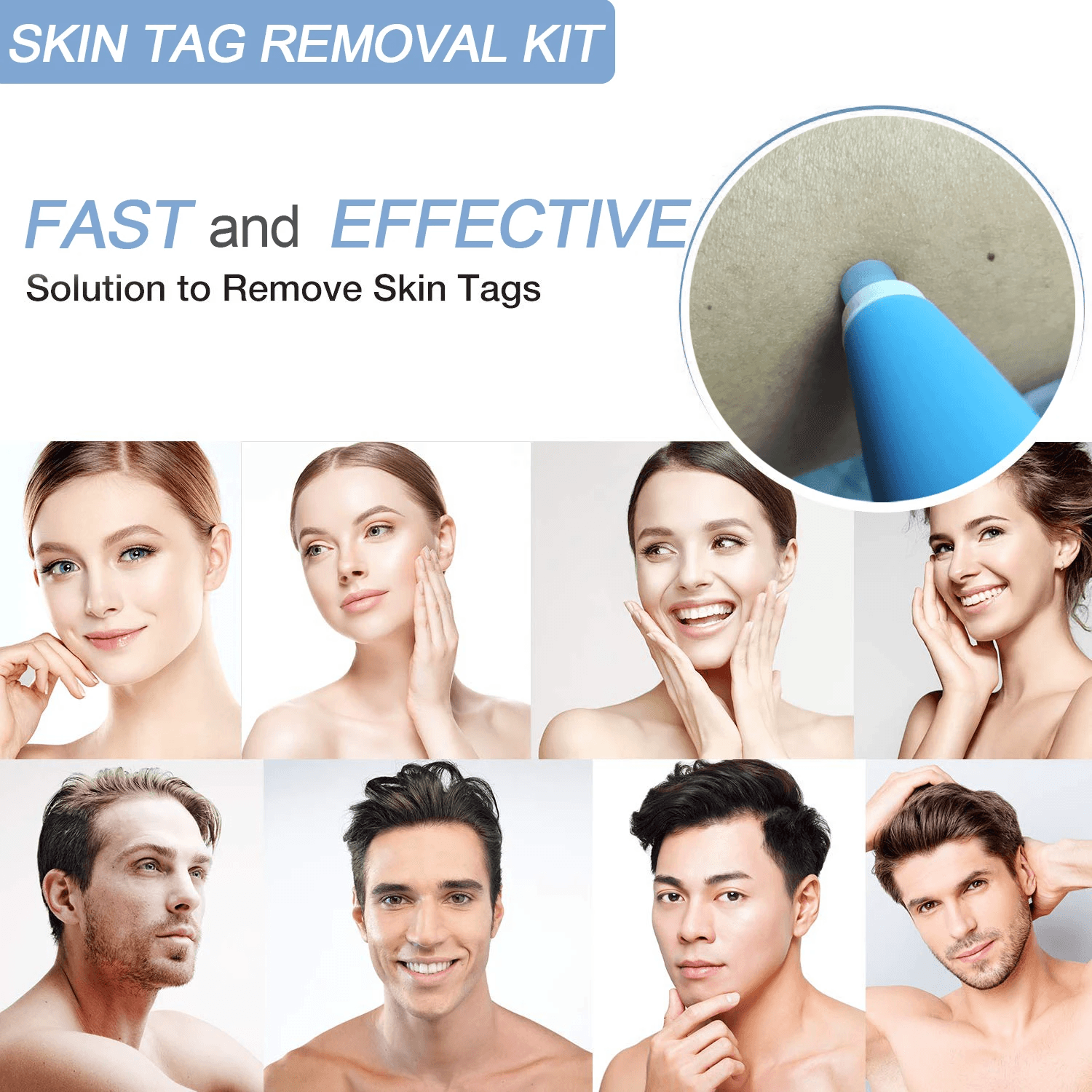 skin tag banding tool for smooth skin