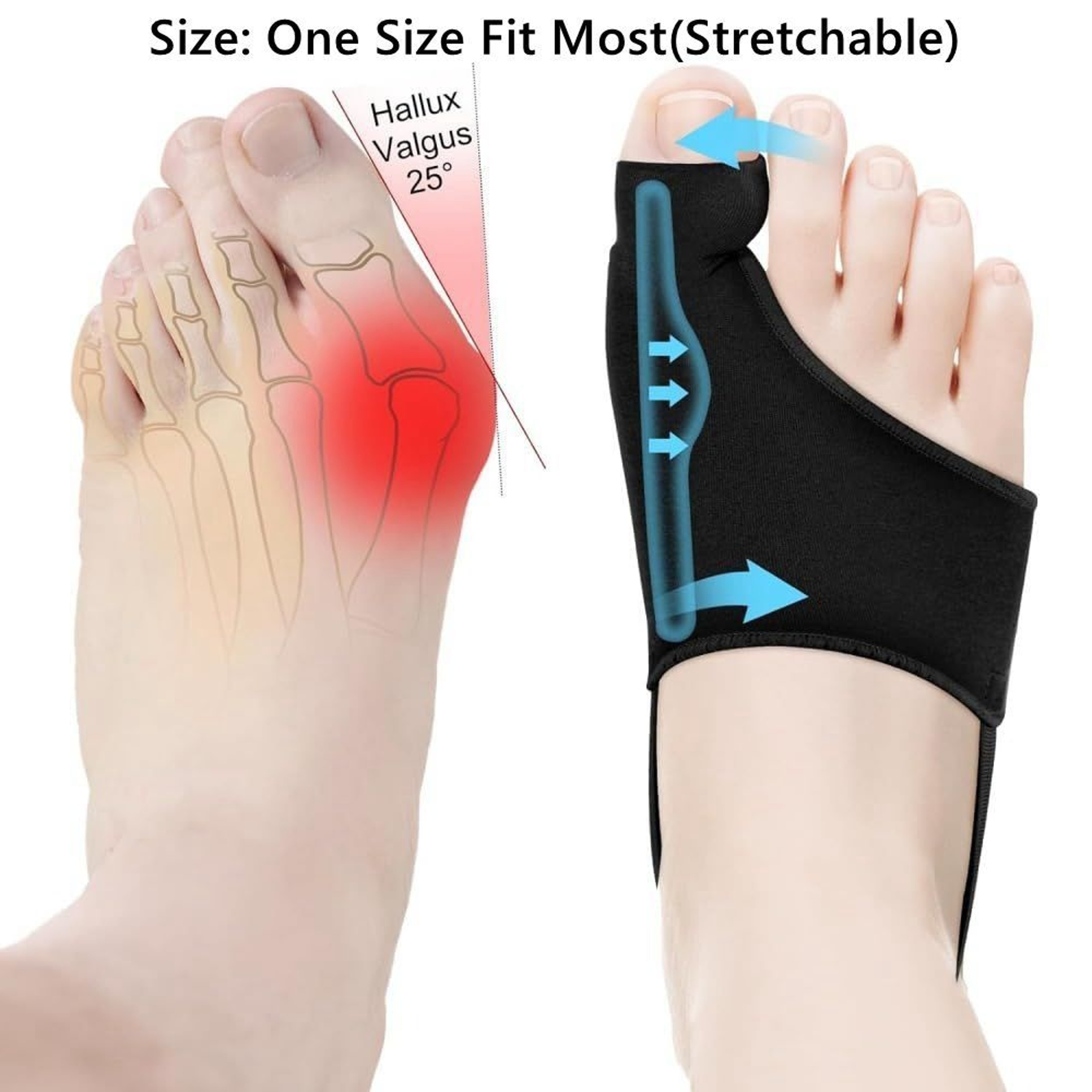 Stretchable Bunion Corrector, Non-Slip Breathable Socks for Hallux Valgus Relief – view 6