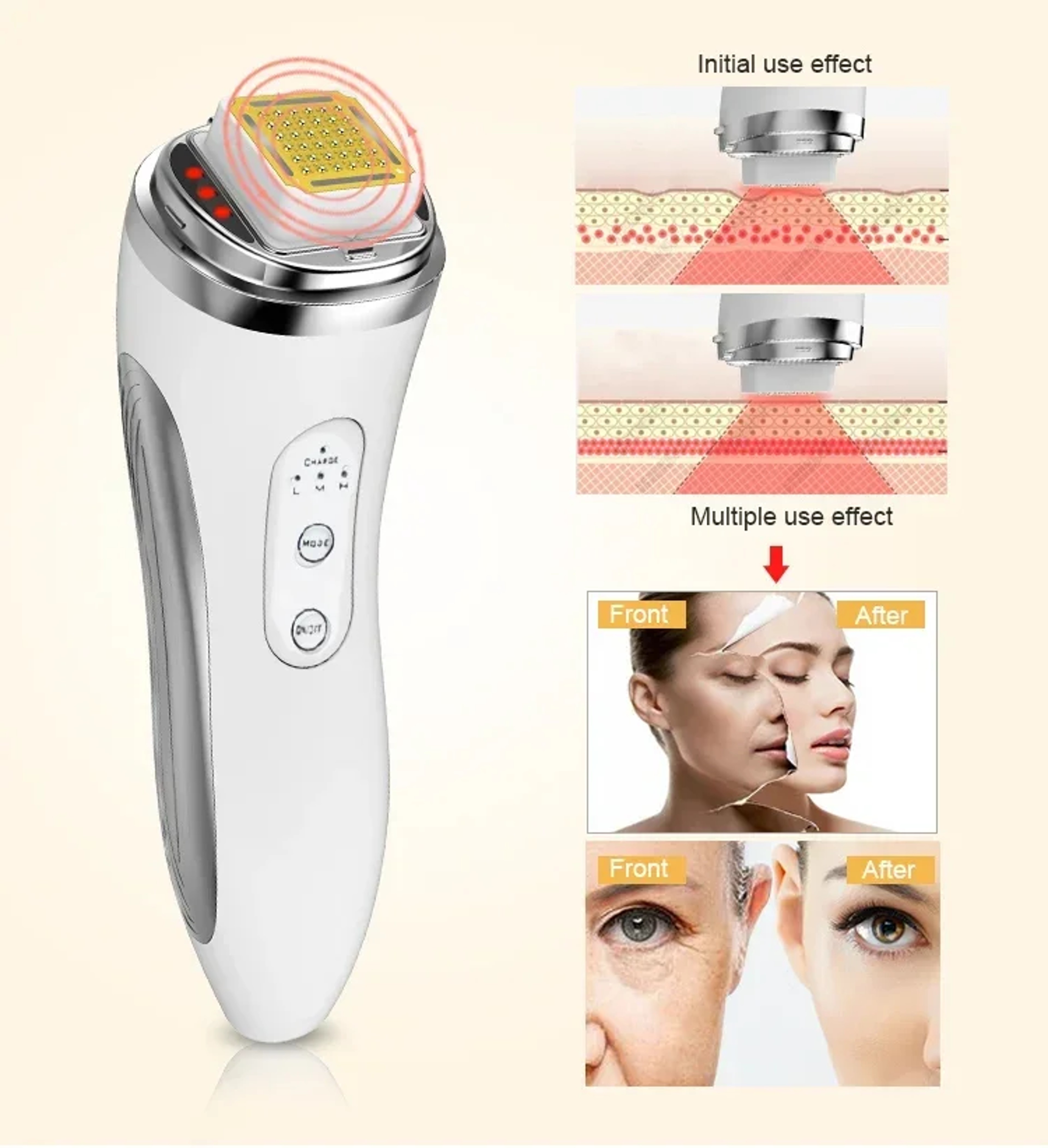 Dot Matrix RF Radio Frequency Face Lifting Device Skin Tightening Beauty Massager  Wrinkle Remover  3