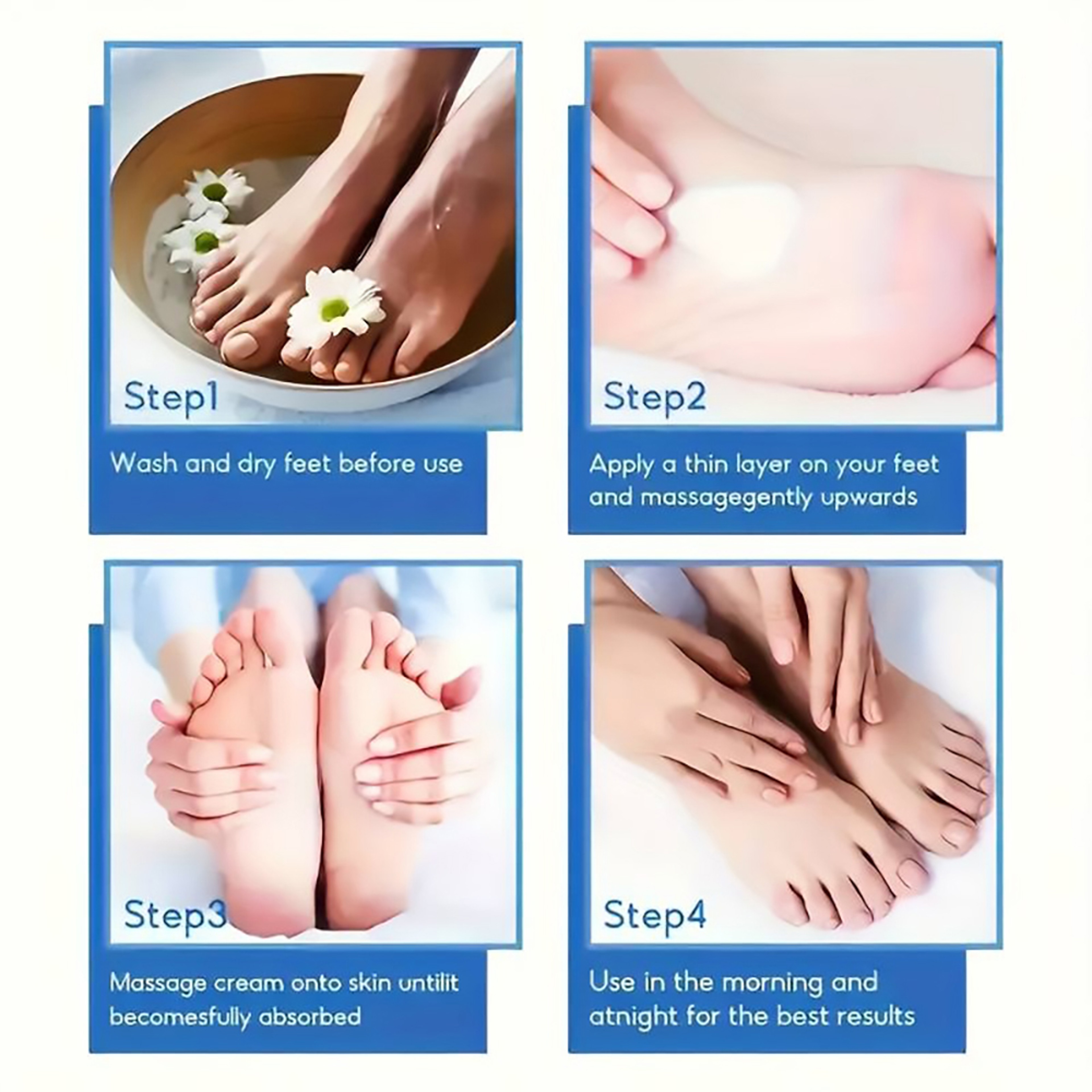 Callus Remover Cream For Cracked Heels  Intensive Dry Skin Treatment Diabetic Foot Care Solution 5